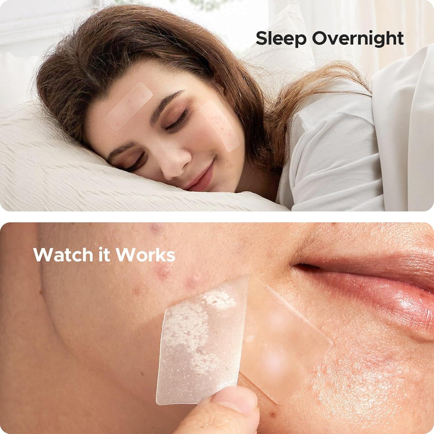 Parche Hidrocoloide XL TKTK 60 mm para Granos y Acné