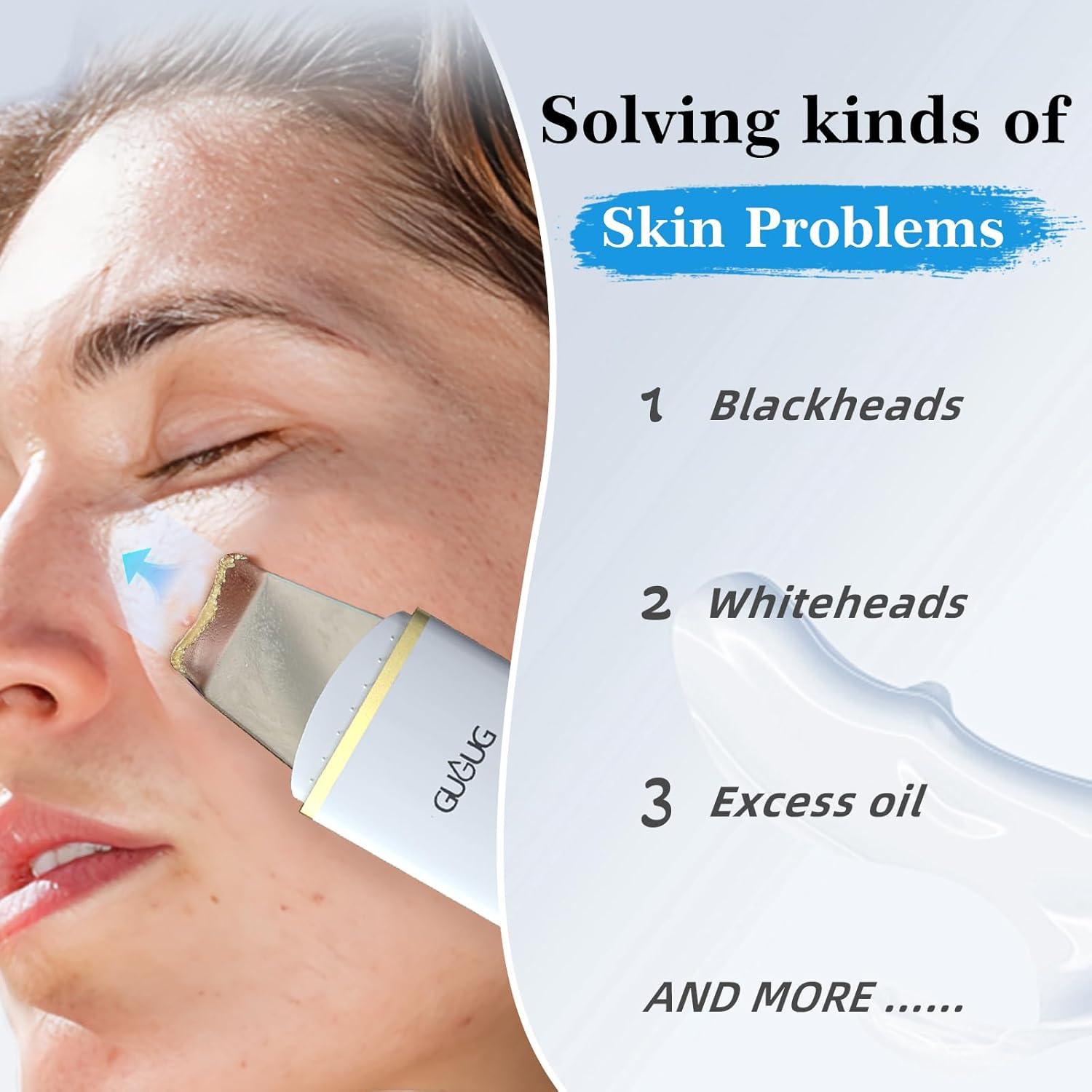 Espátula Facial GUGUG BS-357 Limpiadora de Puntos Negros