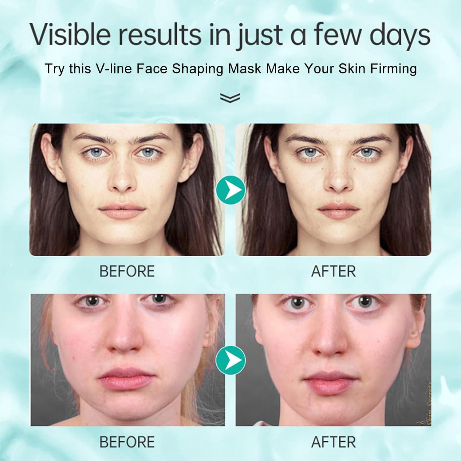 V Line Lifting Mask, Double Chin Mask, Double Chin Reducer, Neck Skin Chin Contour Tightening Firming Face Lift Tape Mask, Chin Strap for Double Chin for Women, with Collagen, Hydrating Anti-aging