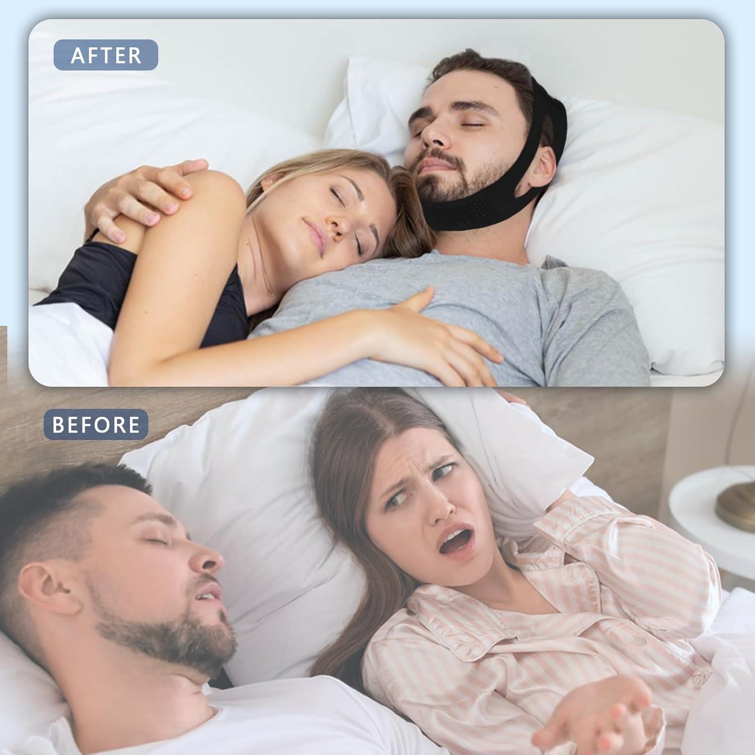 Correa para Barbilla Anti Ronquidos Leyoviz - Ajustable y Transpirable