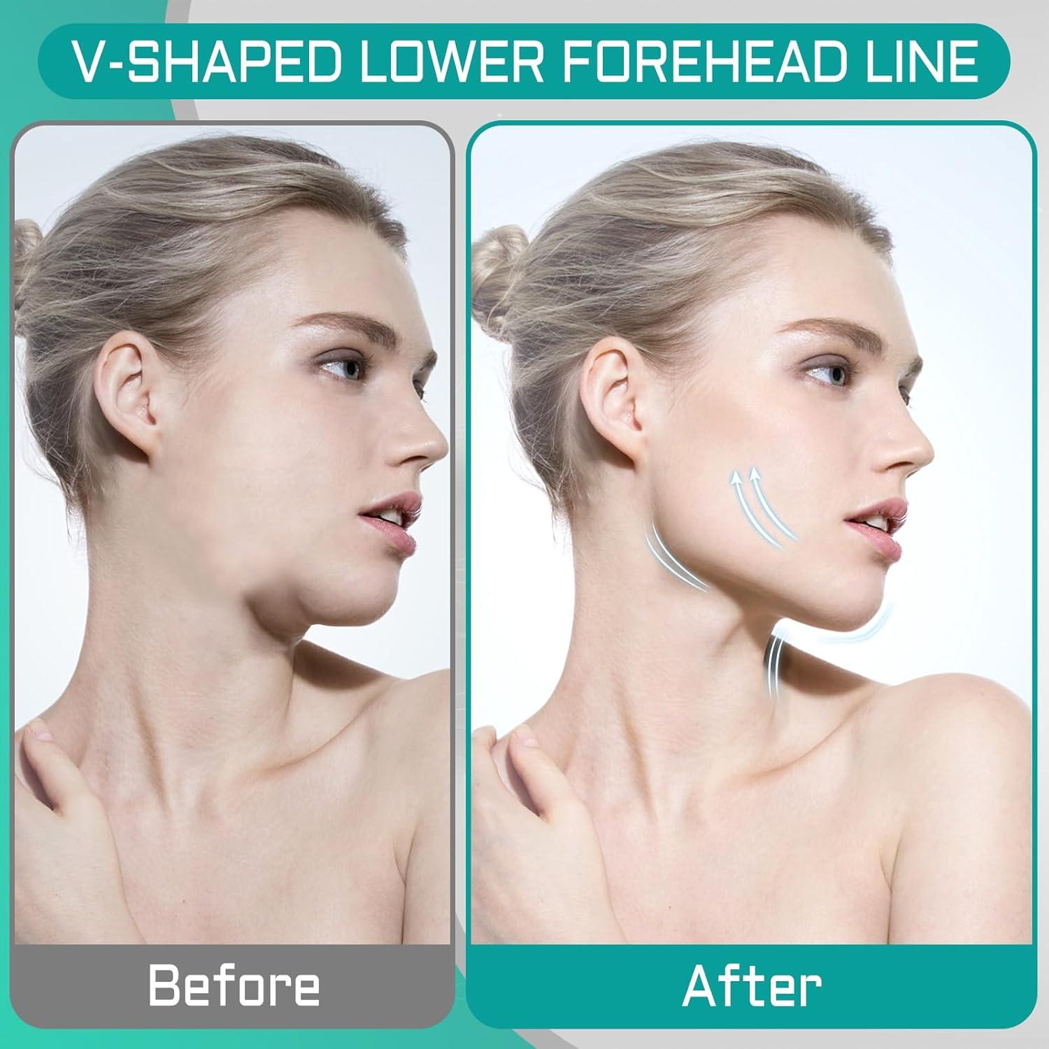 Ejercitador de Mandíbula PAFUWEI 4 Niveles Resistencia Silicona