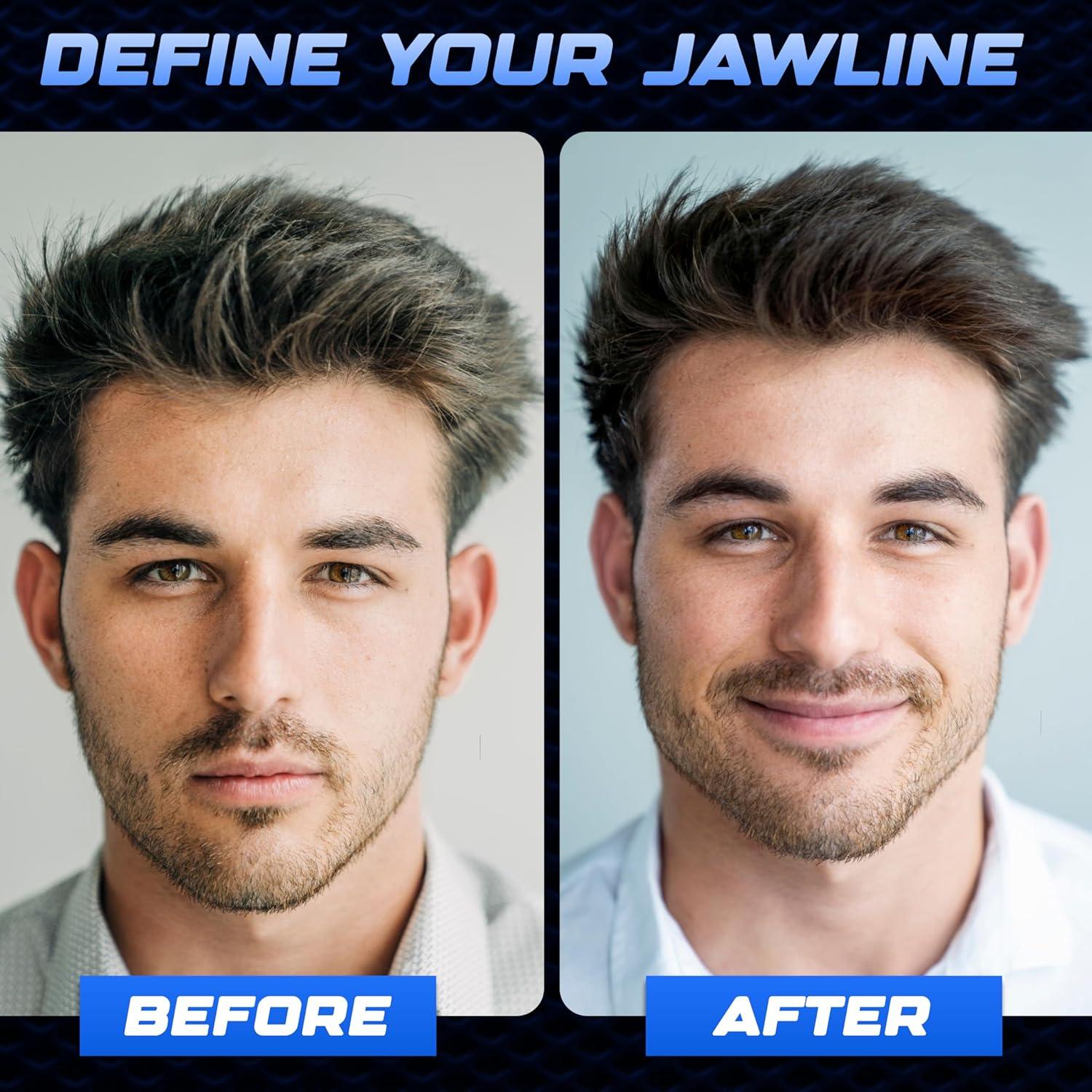 Ejercitador de Mandíbula DASZERX | Silicona 3 Niveles