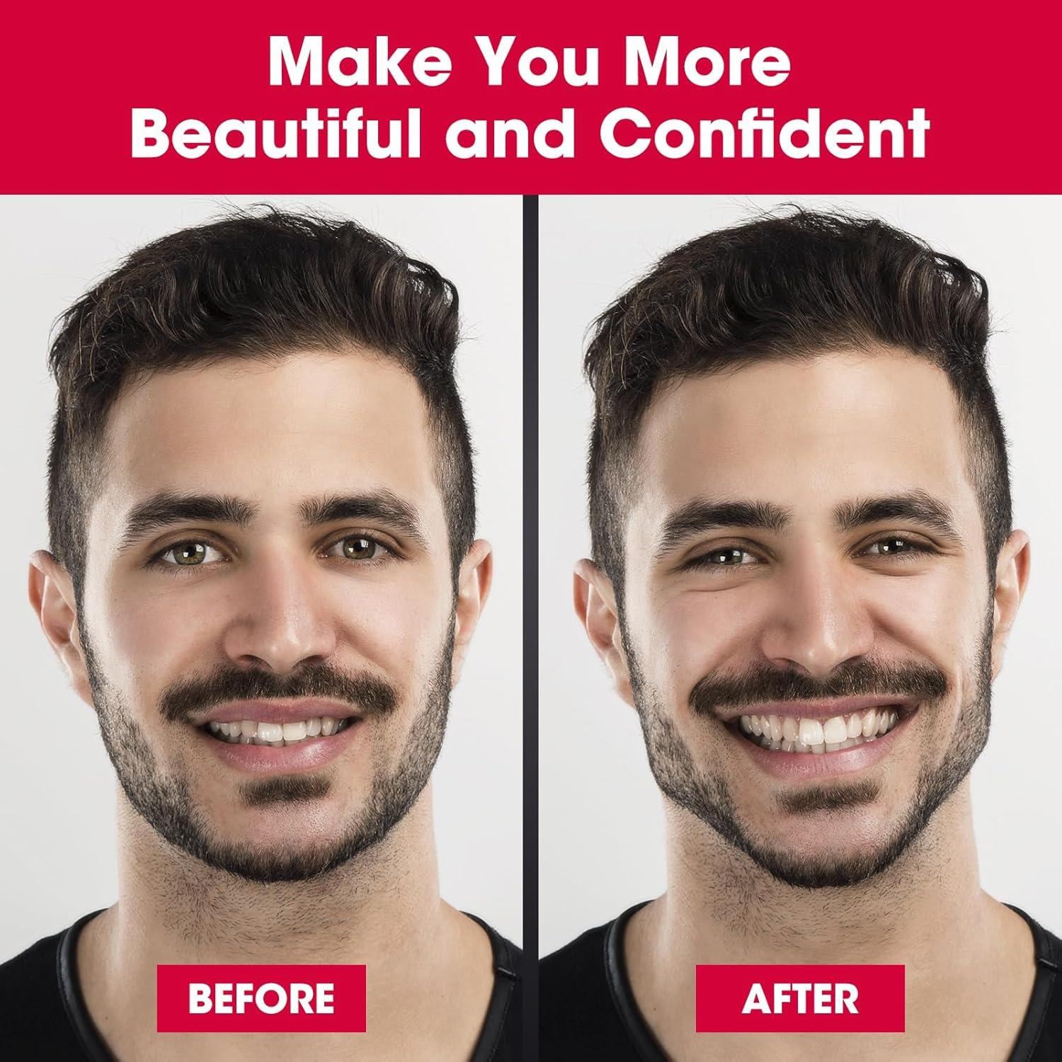 CXYARY 6PCS Jaw Exerciser for Men & Women, 3 Resistance Levels, Silicone Jawline Exerciser, Jaw Trainer Strengthener, Jawline Shaper, White+Grey+Black( U.S. Patent in Application Process)