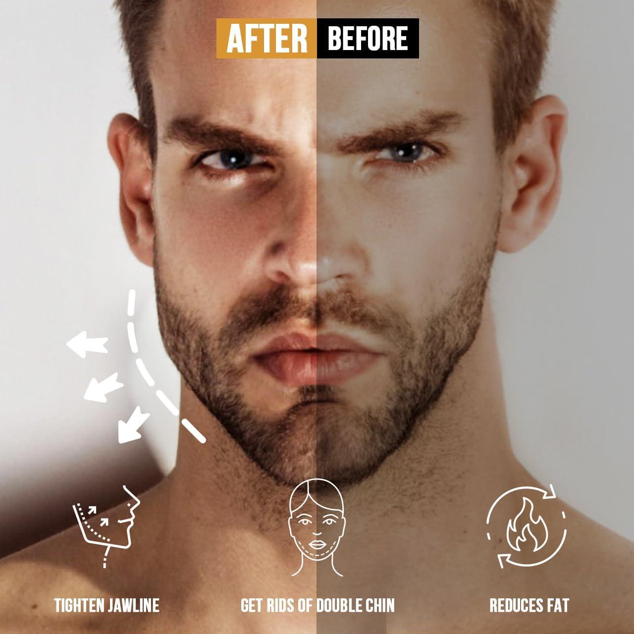 Ejercitador de Mandíbula HUGEOAKS JE-PRO Resistencia 20-59 kg