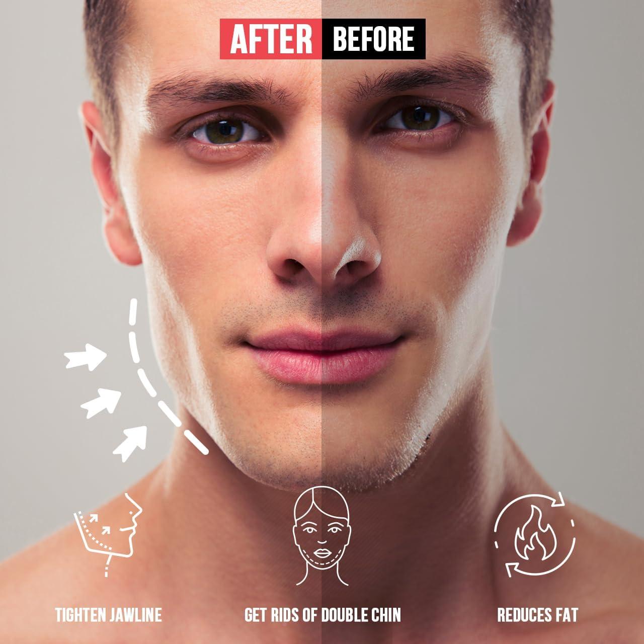 Ejercitador de Mandíbula HUGEOAKS JE 8 Niveles Resistencia