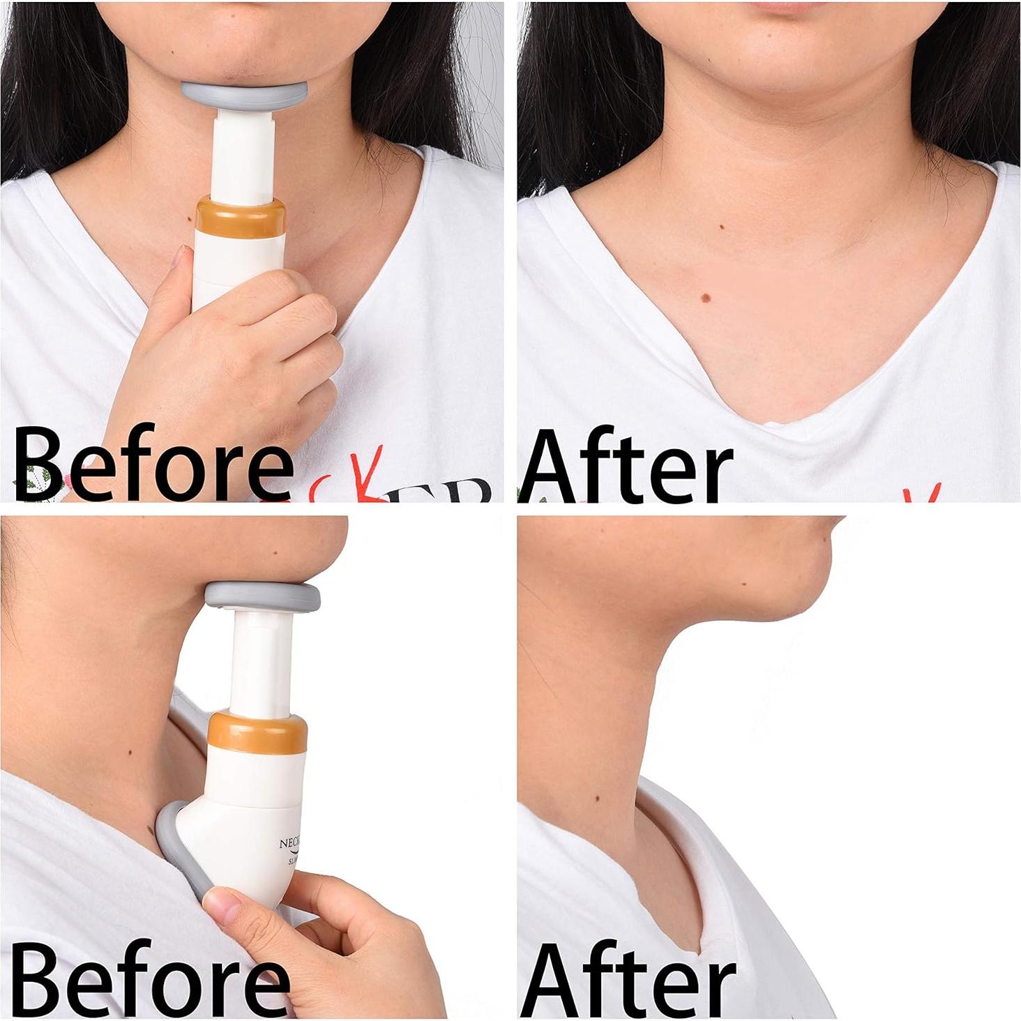 Reductor de Cuello Kare & Kind - Tonificador Facial Portátil