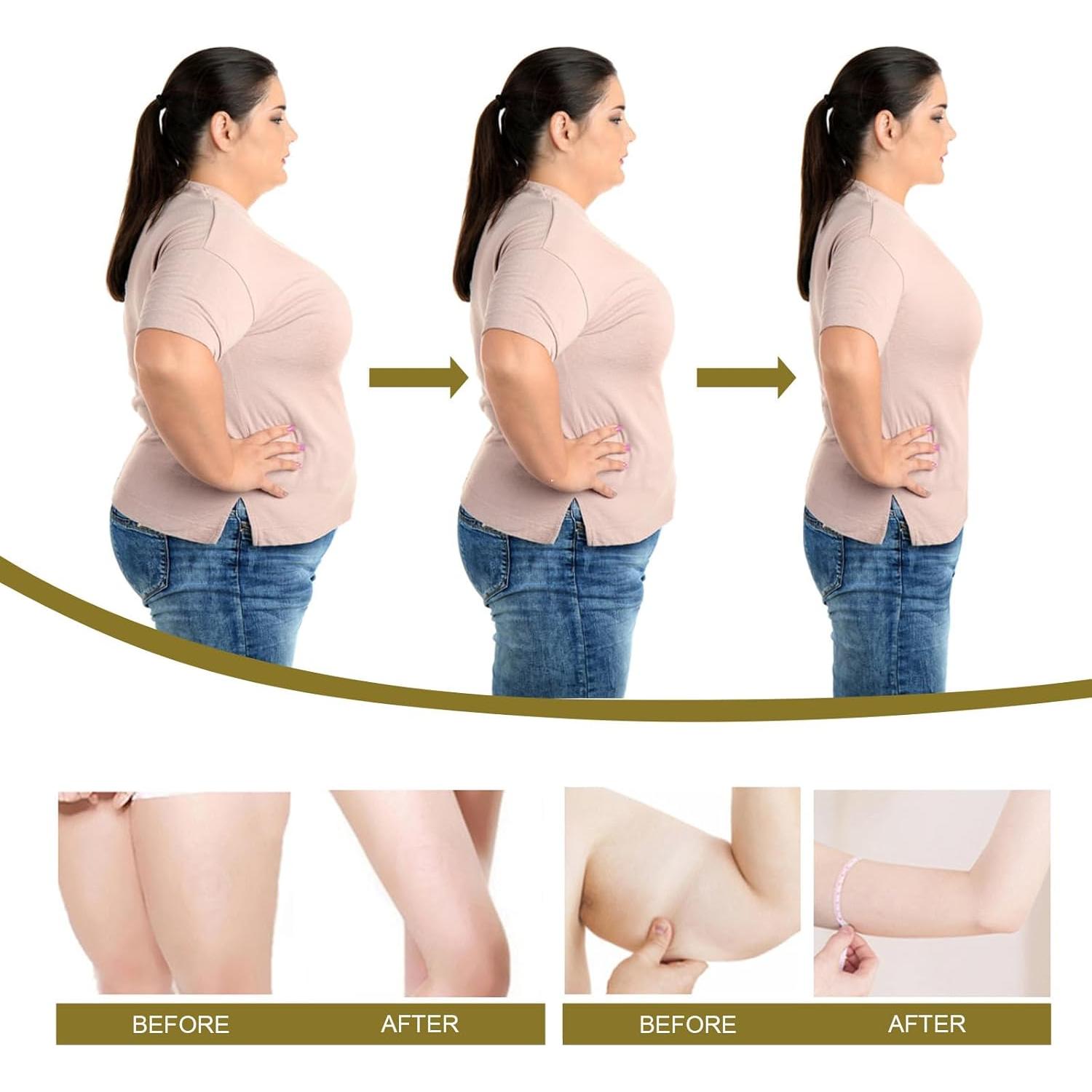 Kit 14 Pcs Anillos Nasales de Veneno de Abeja - Drenaje Linfático