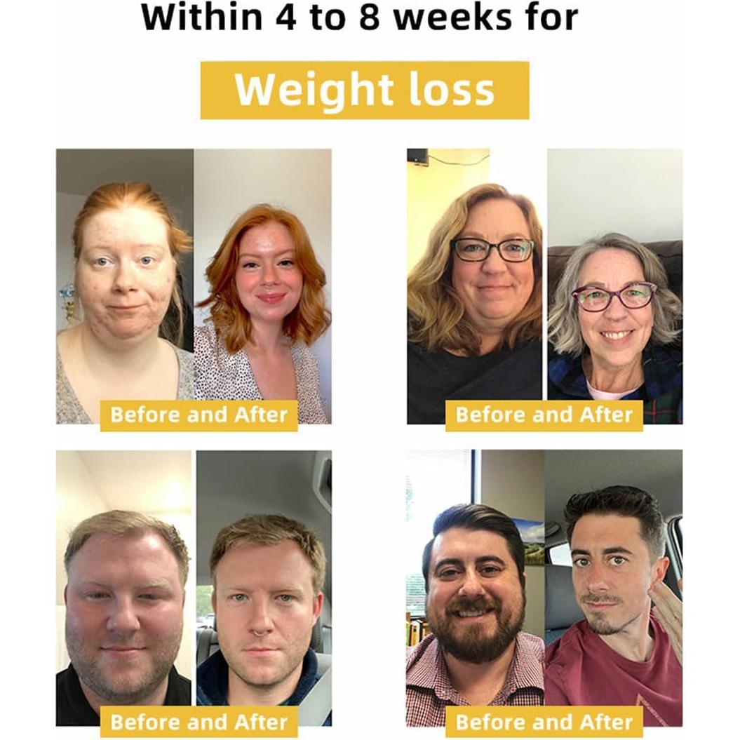 Kit 14 Pcs Anillos Nasales de Veneno de Abeja - Drenaje Linfático