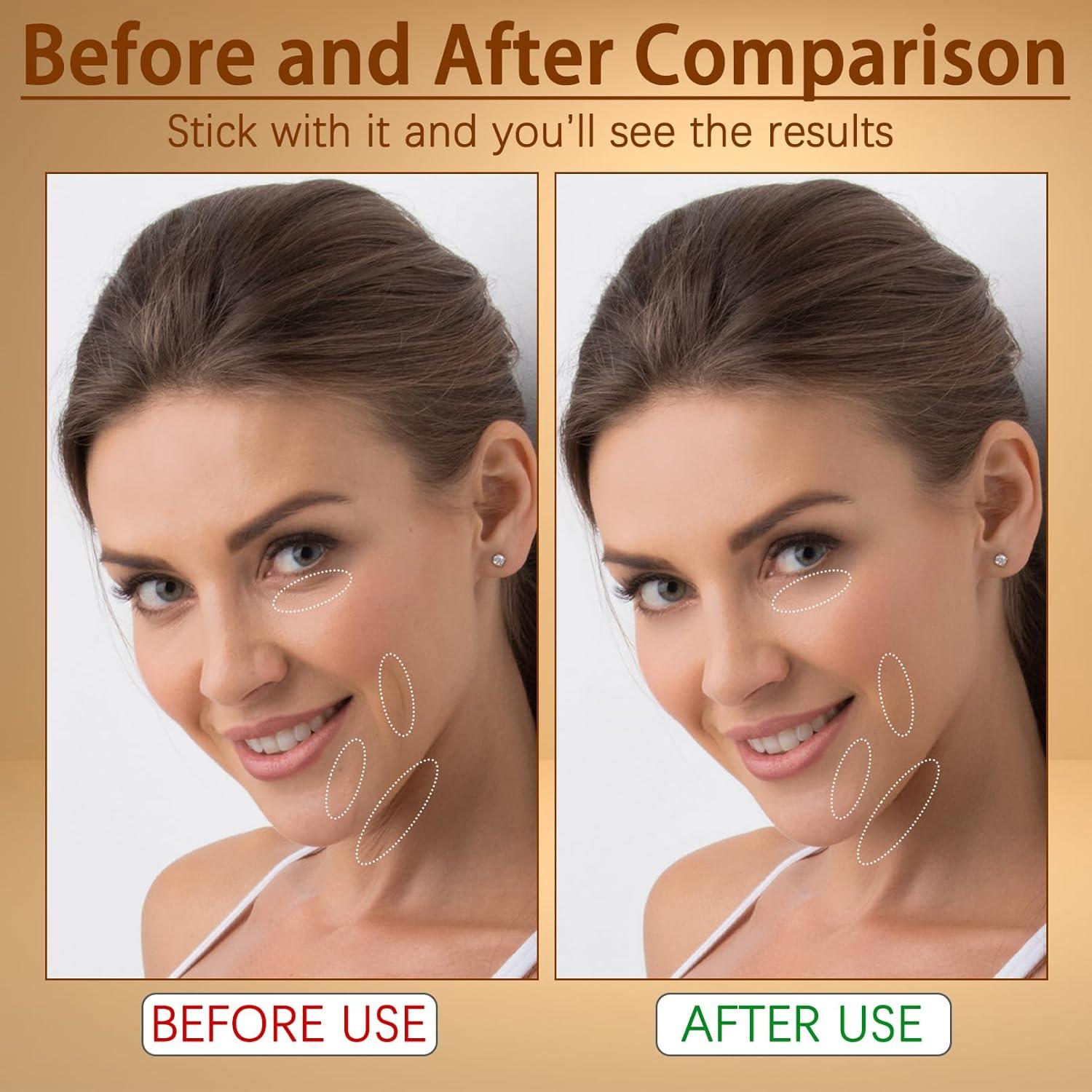 Masajeador Facial 7-en-1 VGY Terapia Luz Roja Compacto