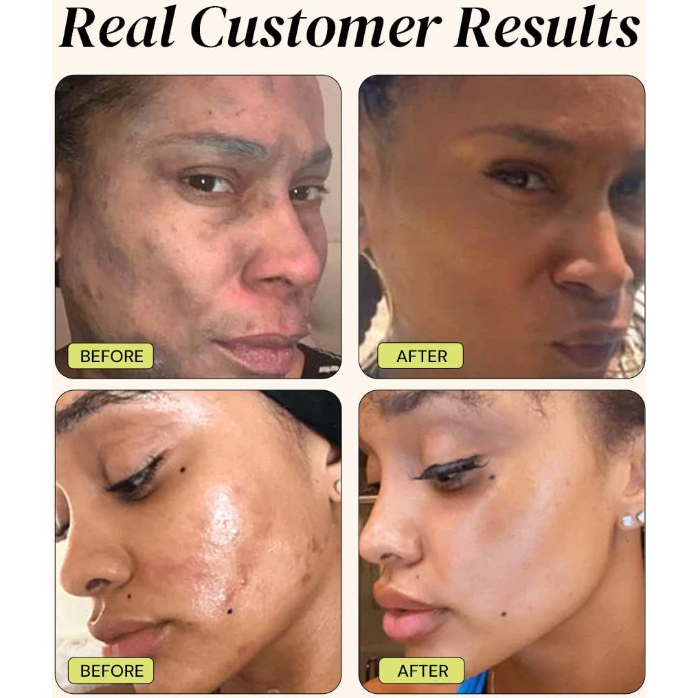 Mascarilla de Arcilla Gleamin 2.5 Oz para Manchas Oscuras