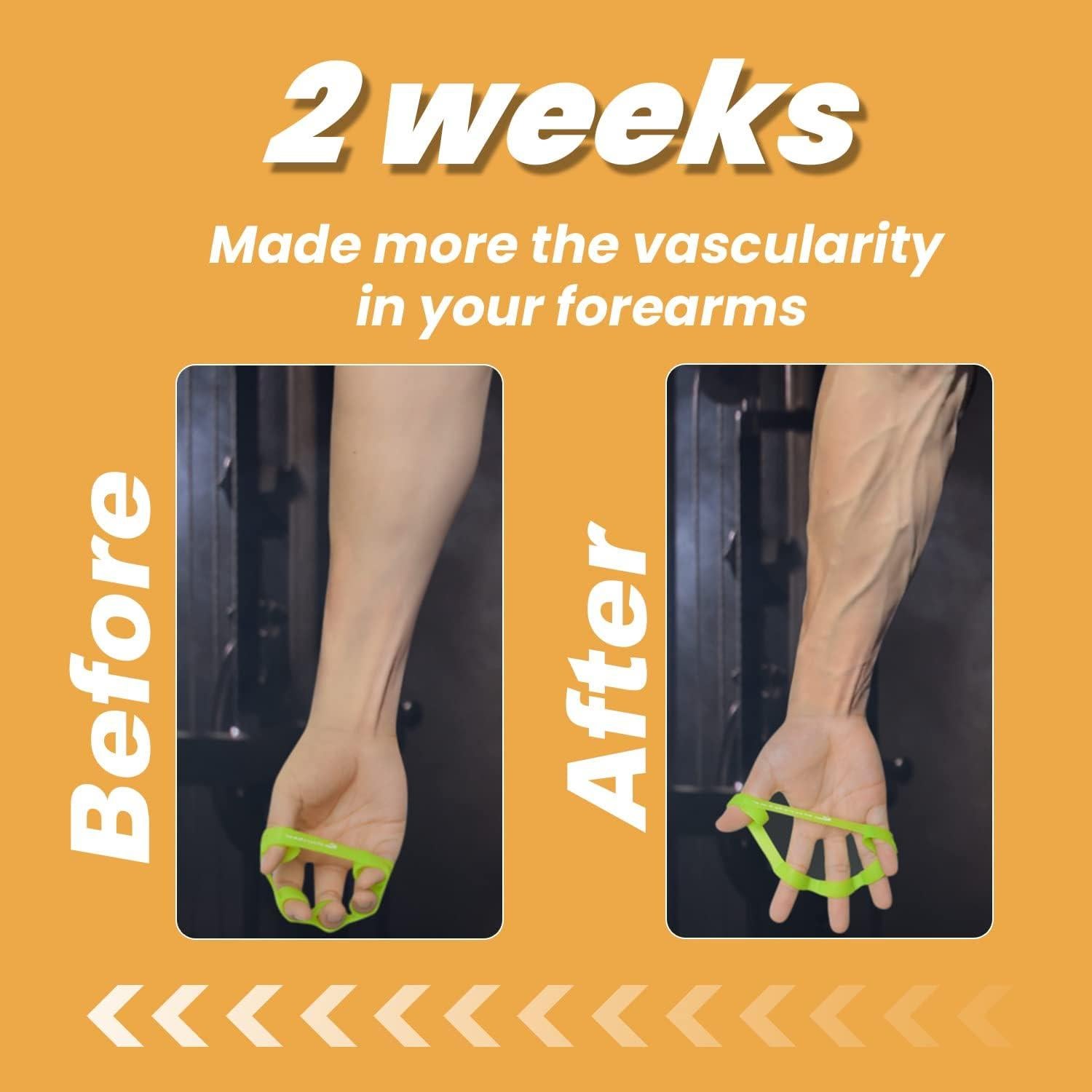 Ejercitador de Dedos Pnrskter 6 PCS - Fortalecedor de Agarre