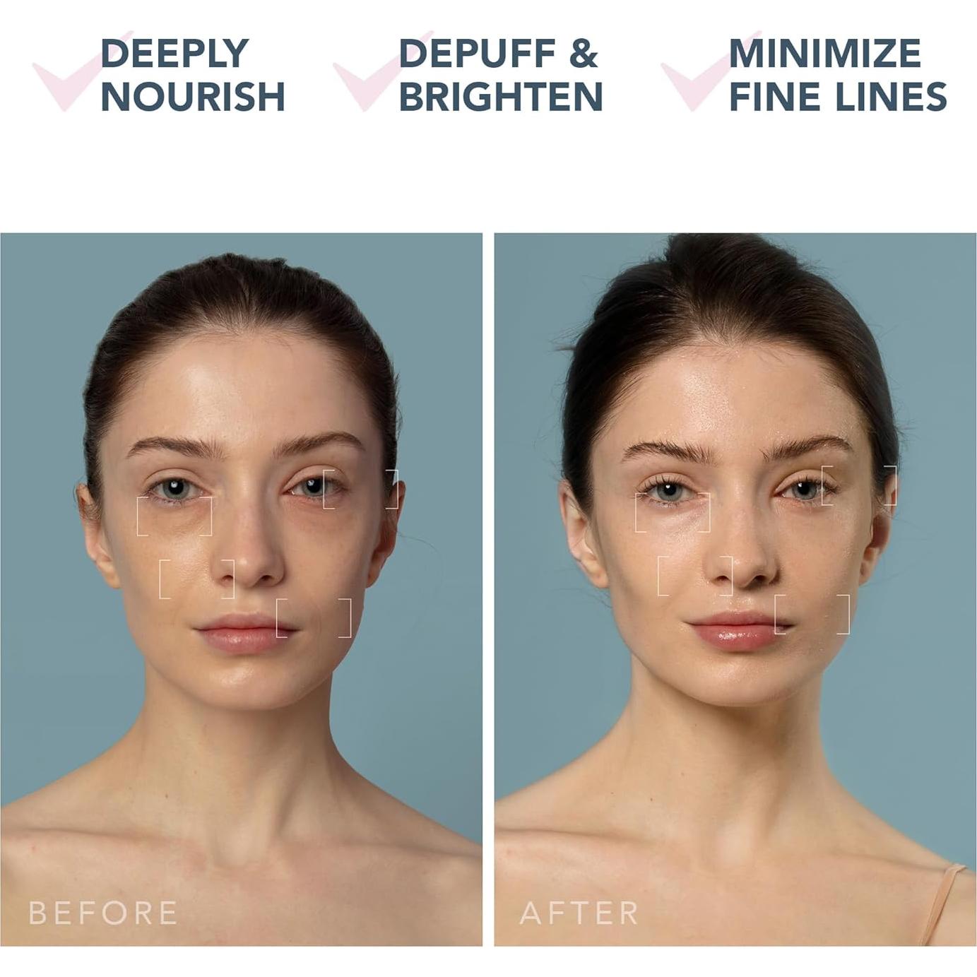 Dispositivo Hidratante Facial FOREO UFO 3 + 14 Máscaras