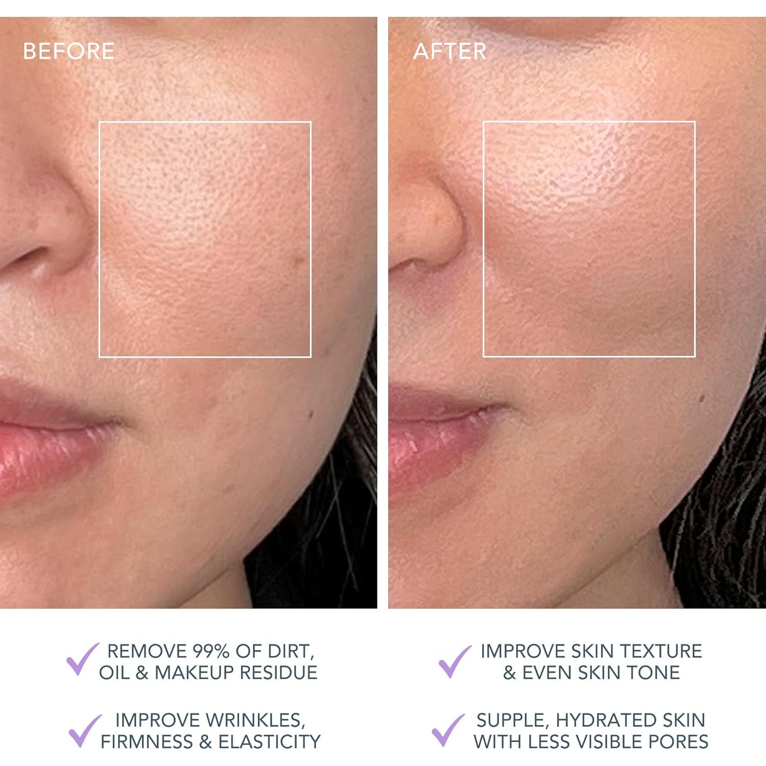 Cepillo Facial Limpiador FOREO Luna 4 Plus - Luz Roja y Microcorriente