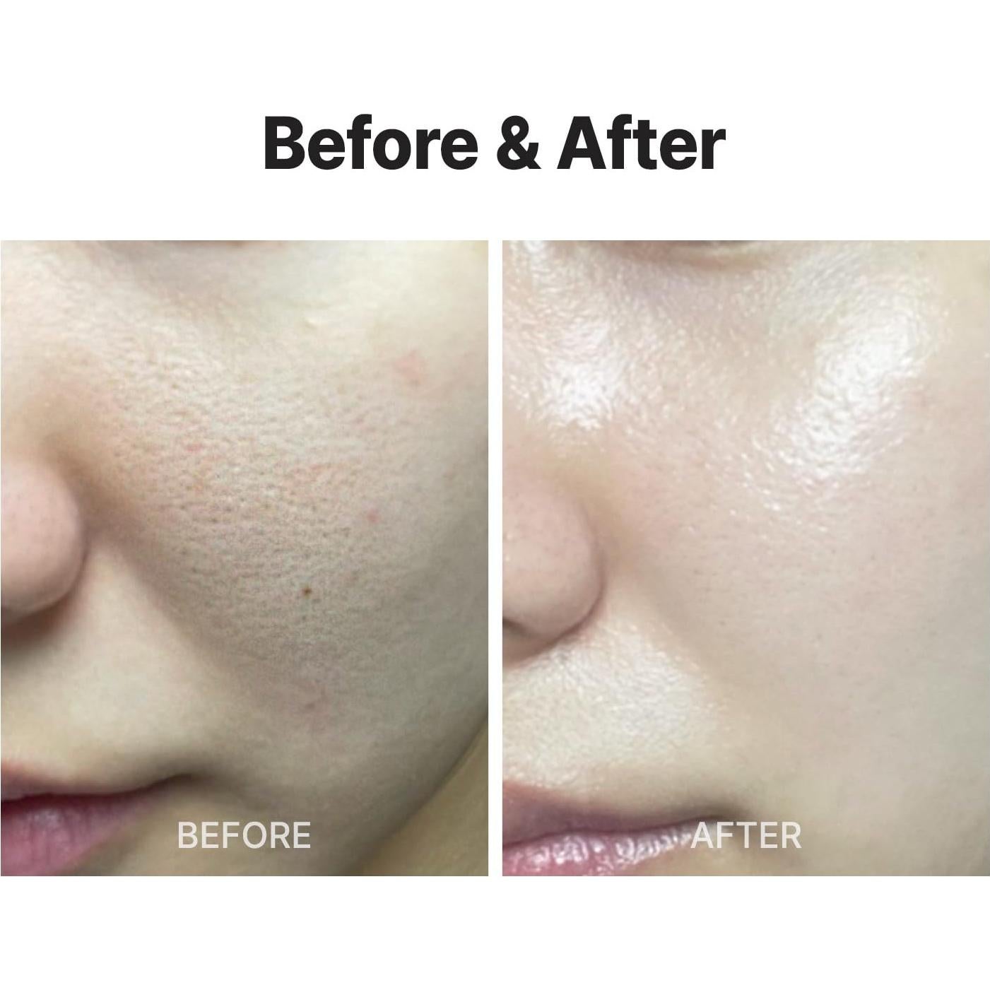 MEDITHERAPY Wrinkle fit Korean Mesh Sheet Masks (7EA), Collagen Mesh Sheet Mask for Glowing Skin, Daily Facial Mask, Hyaluronic acid Facial Mask, Korean Skincare