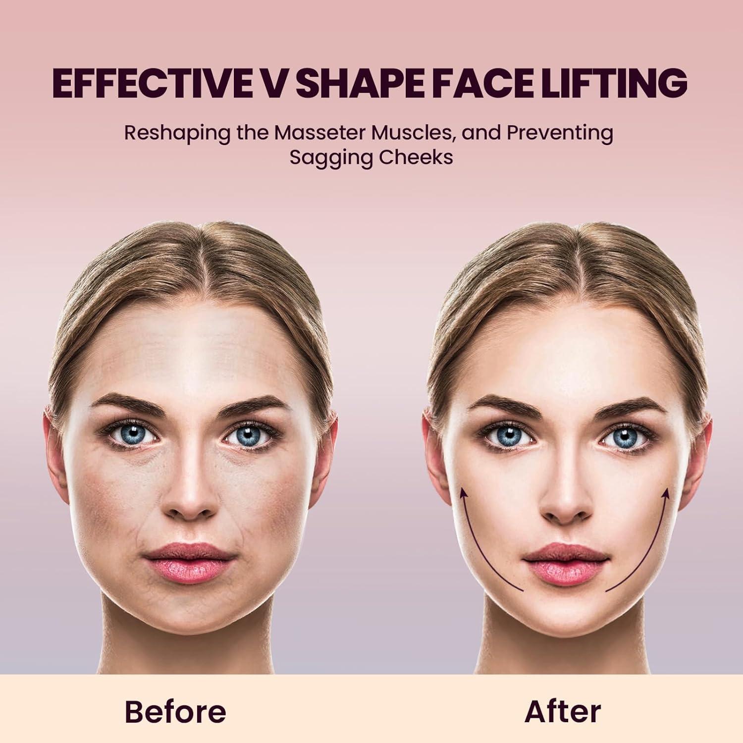 Electric Double Chin Device and V-Face Machine with 8 Modes and 15 Gear Adjustable Intensities - Intelligent Double Chin Machine for V-face