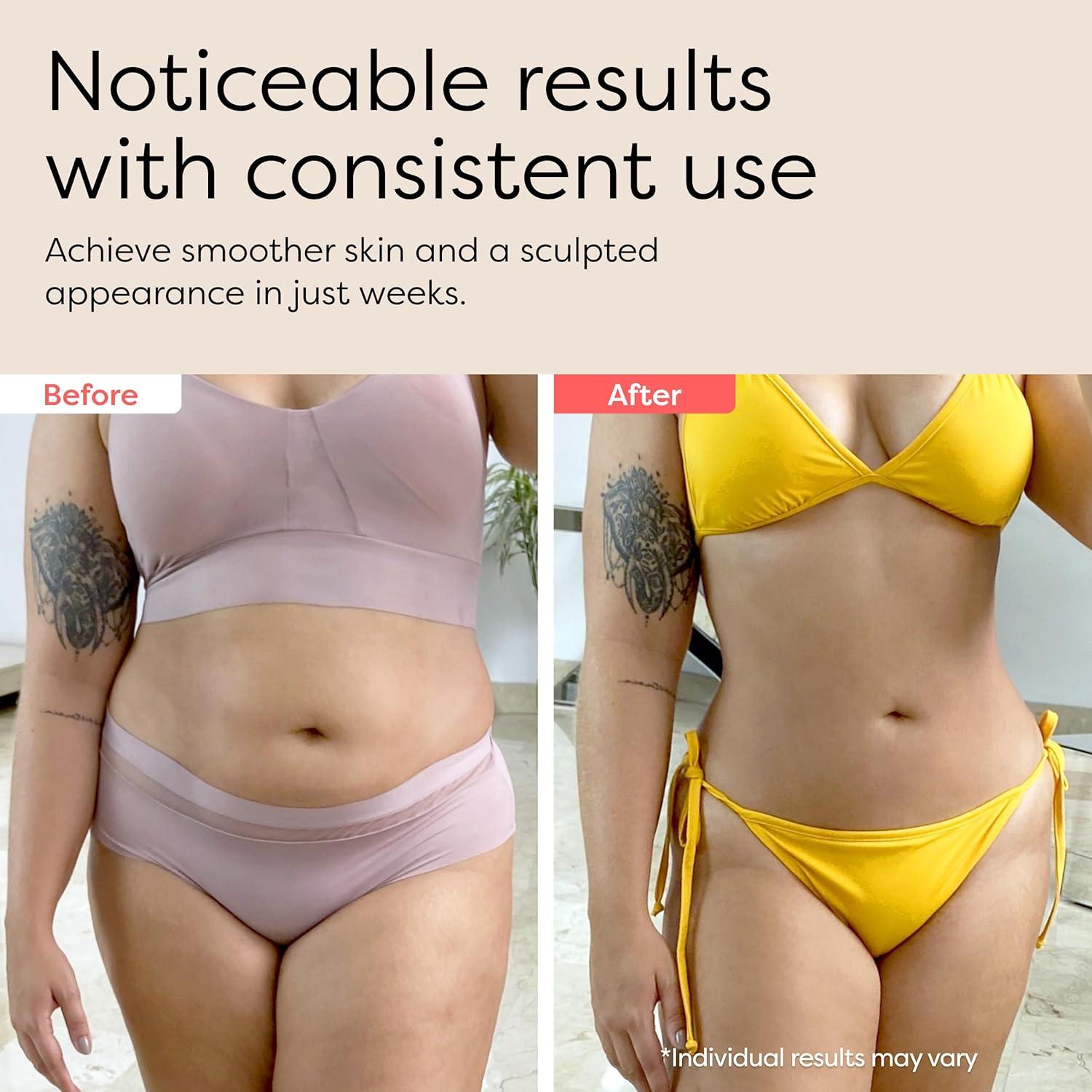 Masajeador Corporal Redu Sculpt 3-en-1 Anticelulitis 0.82kg