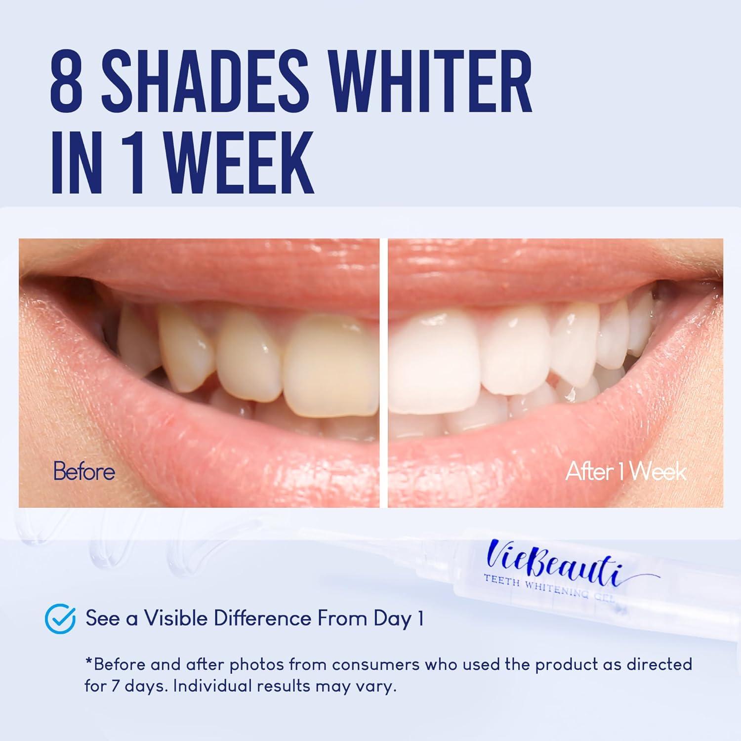VieBeauti Teeth Whitening Kit with LED Light: Tooth Whitener with 35% Carbamide Peroxide, Remineralizing Gel, Mouth Trays and Tray Case - 10-Minute Timer Enhances Minty Fresh White Smile Mint