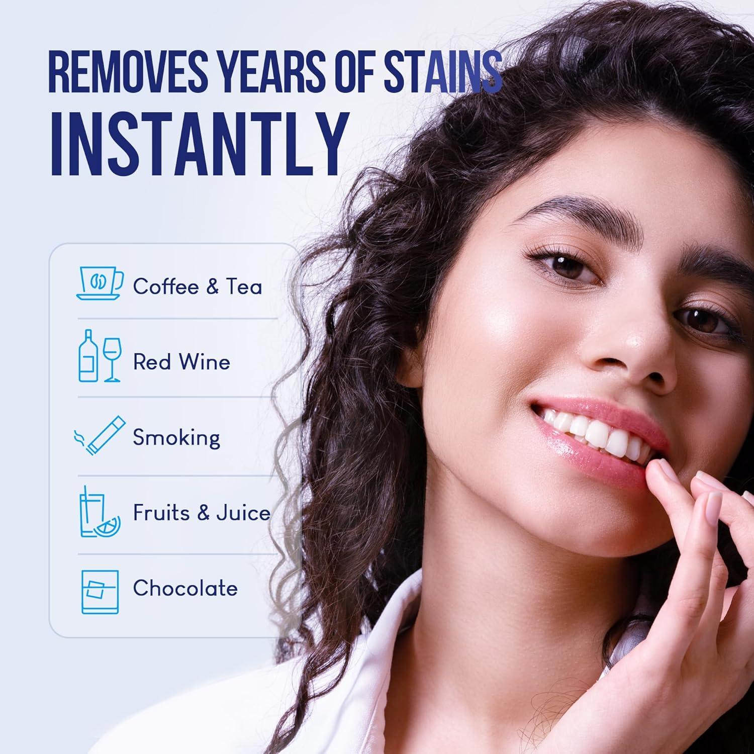 VieBeauti Teeth Whitening Kit with LED Light: Tooth Whitener with 35% Carbamide Peroxide, Remineralizing Gel, Mouth Trays and Tray Case - 10-Minute Timer Enhances Minty Fresh White Smile Mint