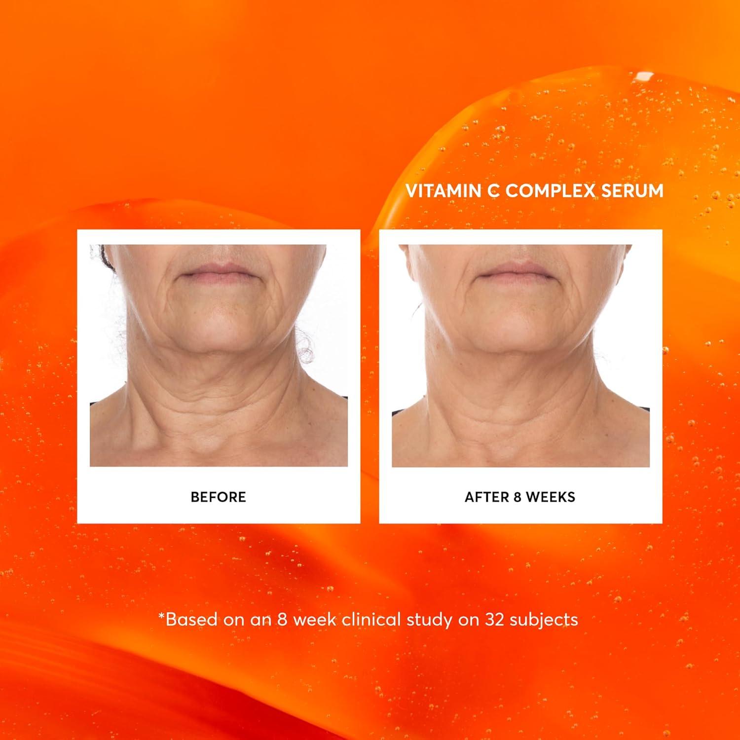 Suero Facial Antienvejecimiento Naturium 28.35 g Vitamina C