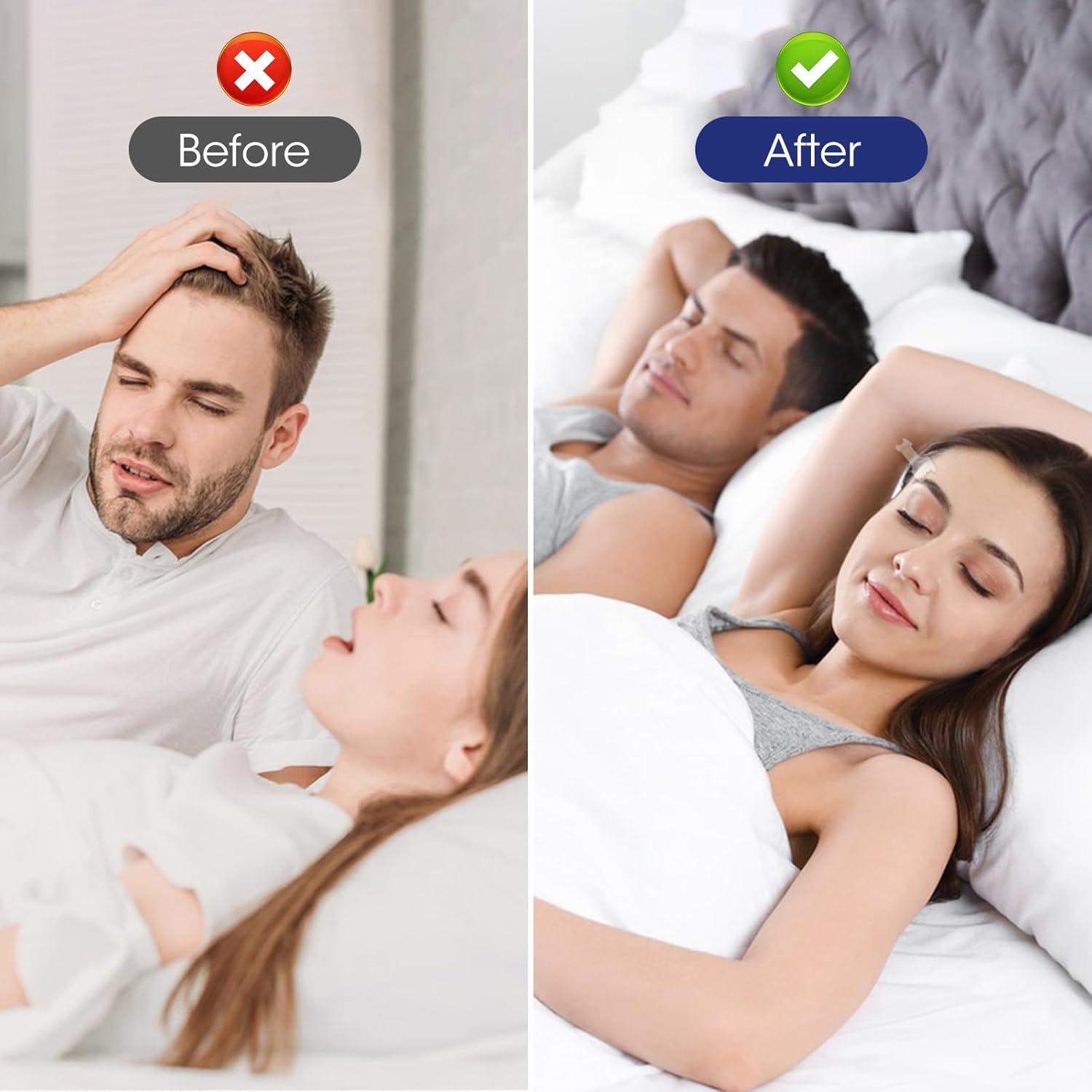 Tiras Nasales MQUPIN 150 Unidades Alivio Ronquidos 66x19mm