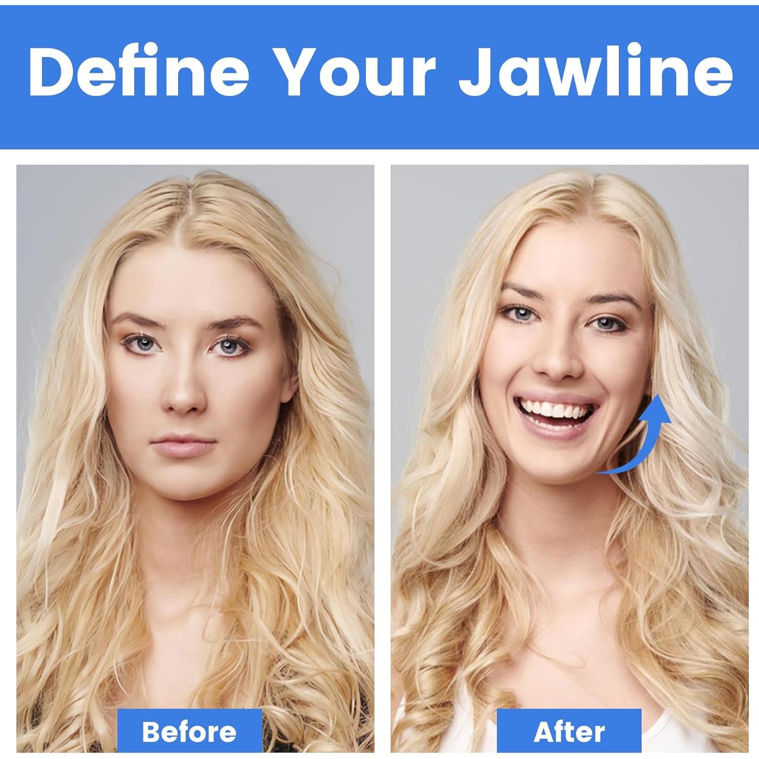 Ejercitador de Mandíbula TEAWOO Set 9PCS 3 Niveles Resistencia