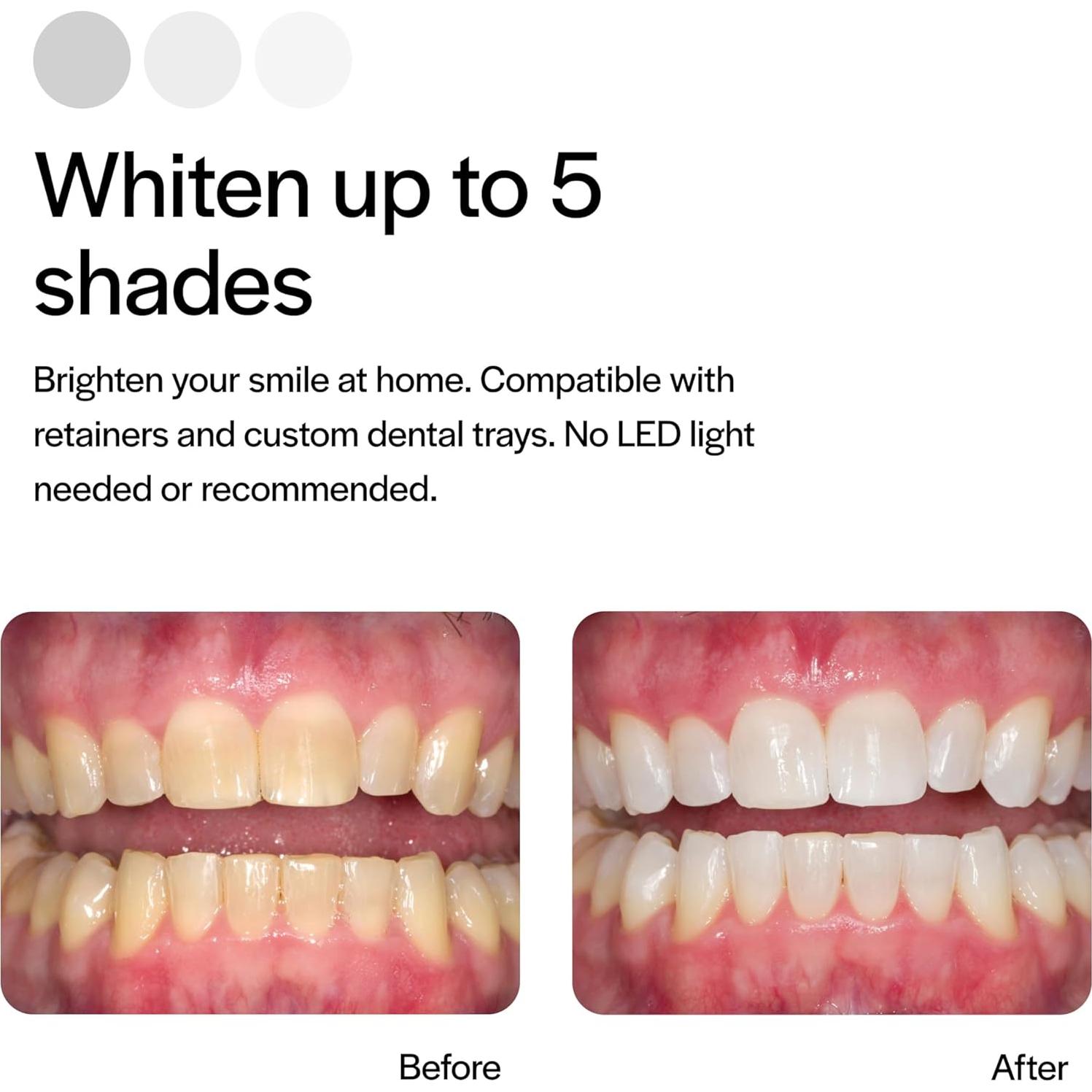 Kit de Blanqueamiento Dental Opalescence 15% - 4 Jeringas