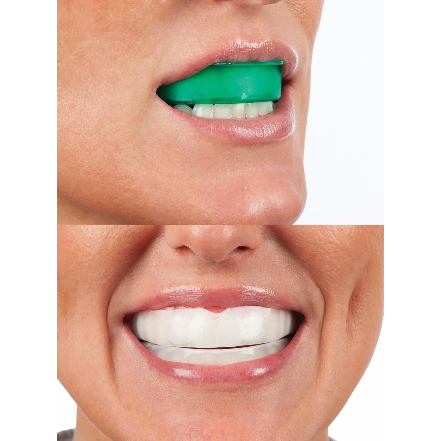 Bandejas Blanqueamiento Dental Opalescence Go 15% - 4 Tratamientos