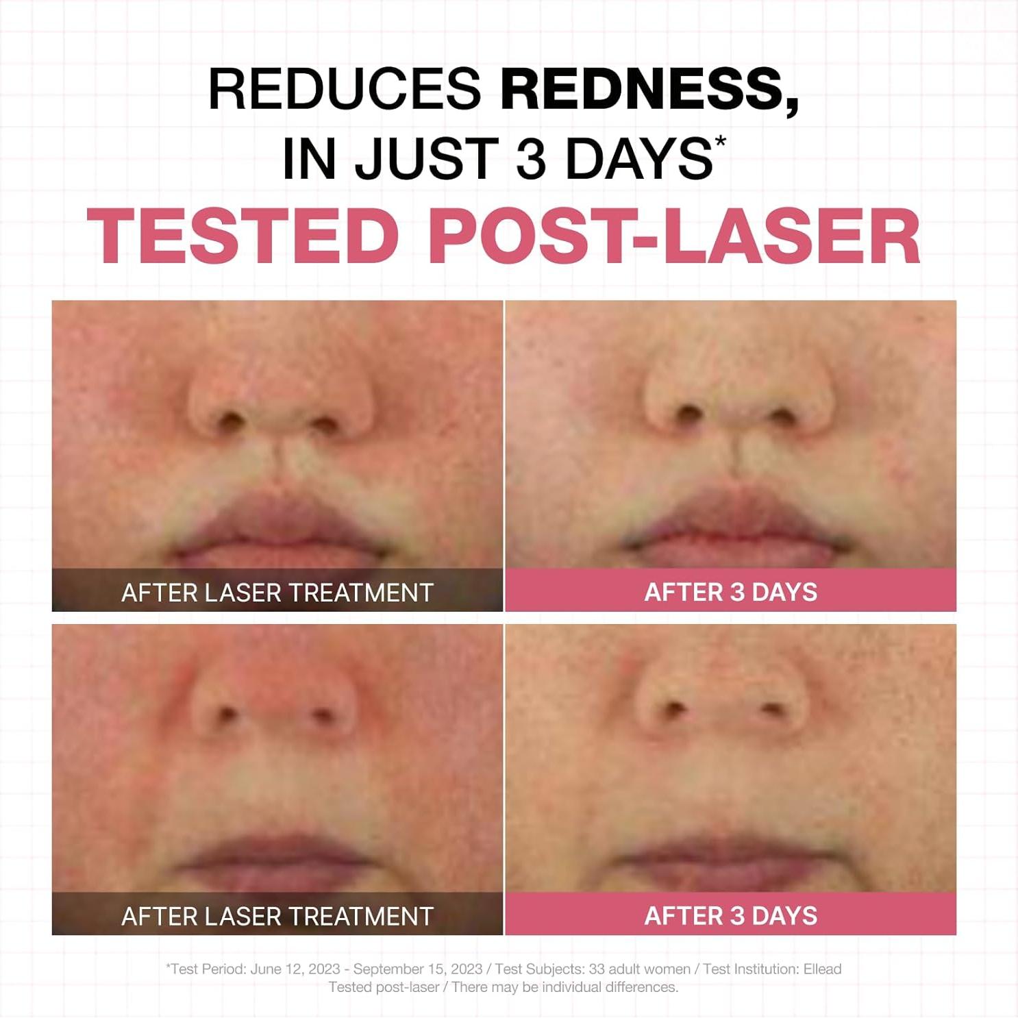 Crema Hidratante Physiogel 50 ml para Piel Seca y Sensible