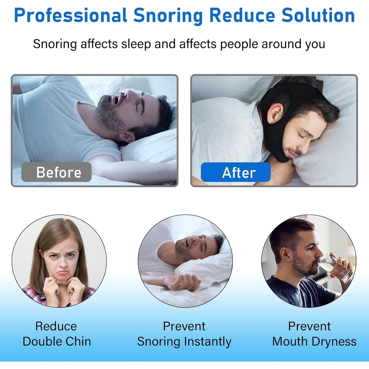 Correa para Barbilla Forzacx CPAP Antironquido Negro 2 Piezas