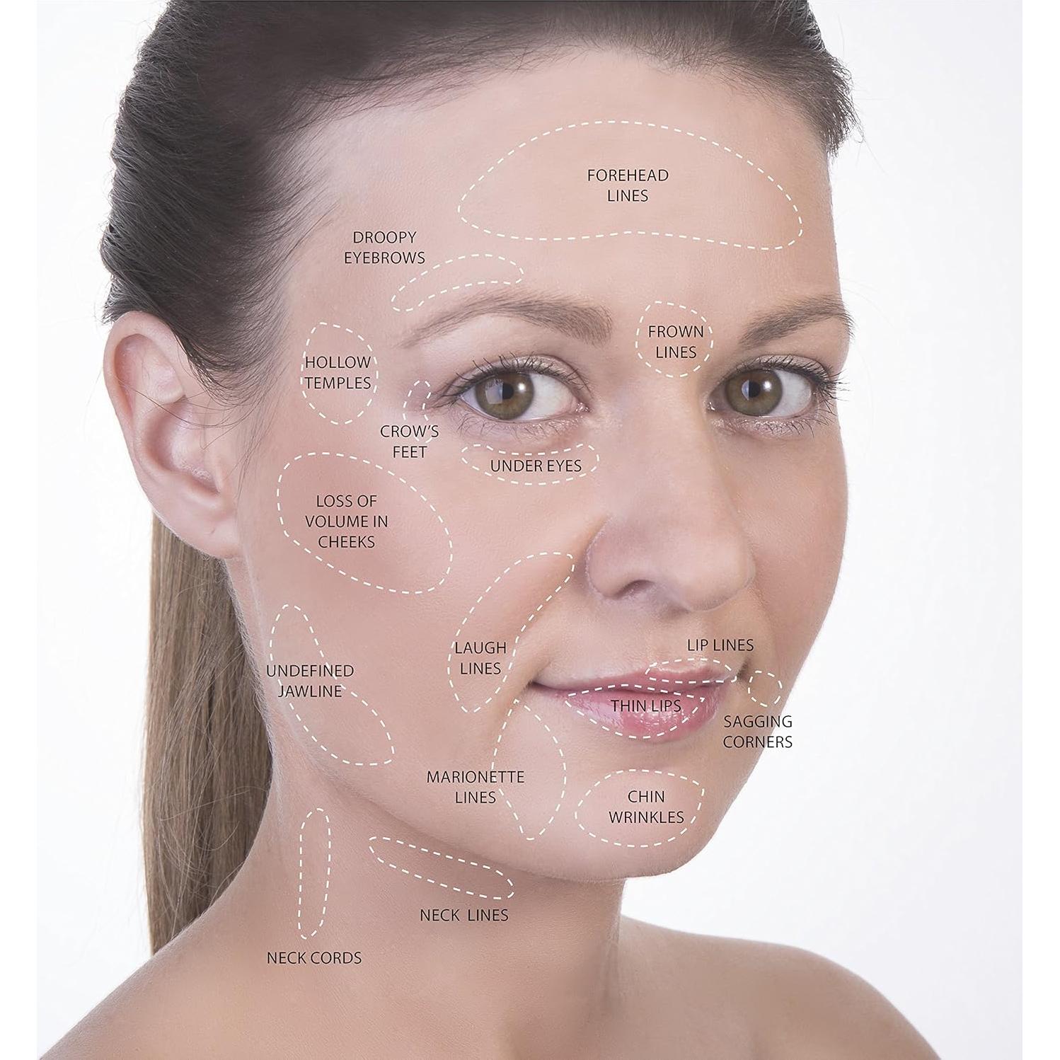 Kit de Ventosas Faciales y Corporales SanDine - 4 Piezas