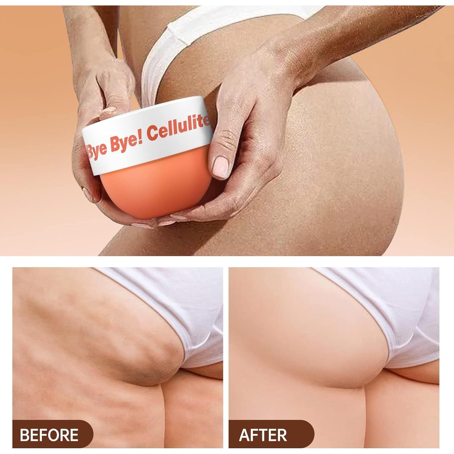 Crema Anticelulitis Caliente LA.PERSONAL 155 Gr con Cafeína