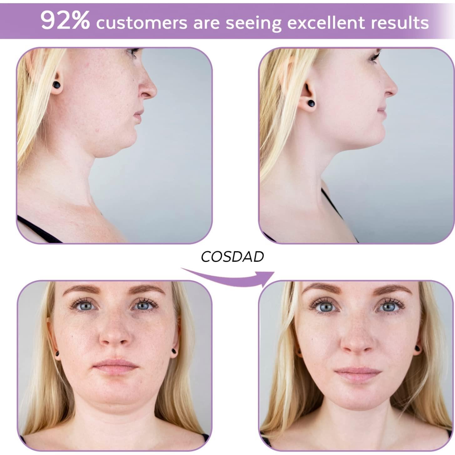 Reductor de Doble Papada COSDAD - Moldeador Facial Púrpura