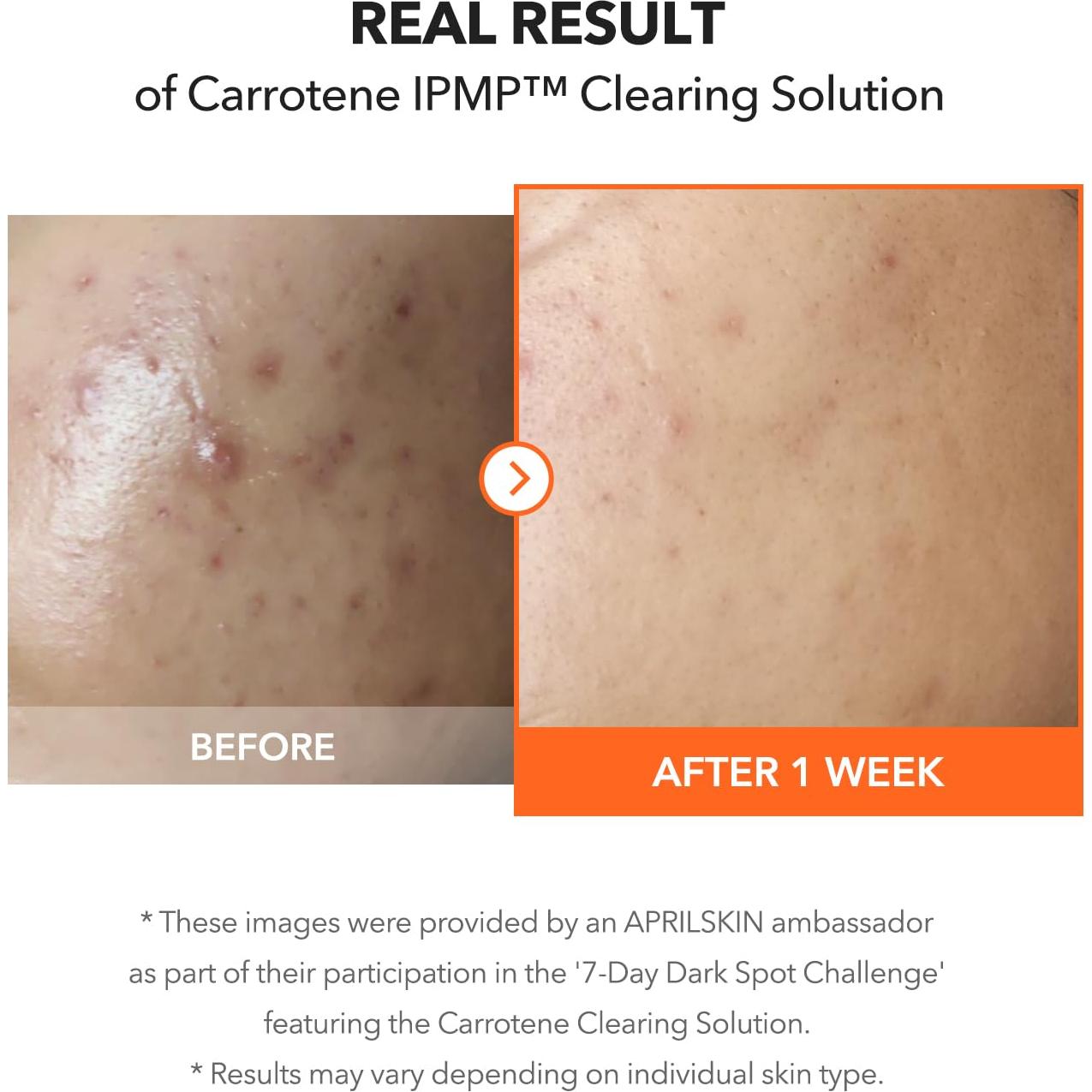 APRILSKIN Solución Limpiadora Carrotene IPMP 19.9ml - Vegana