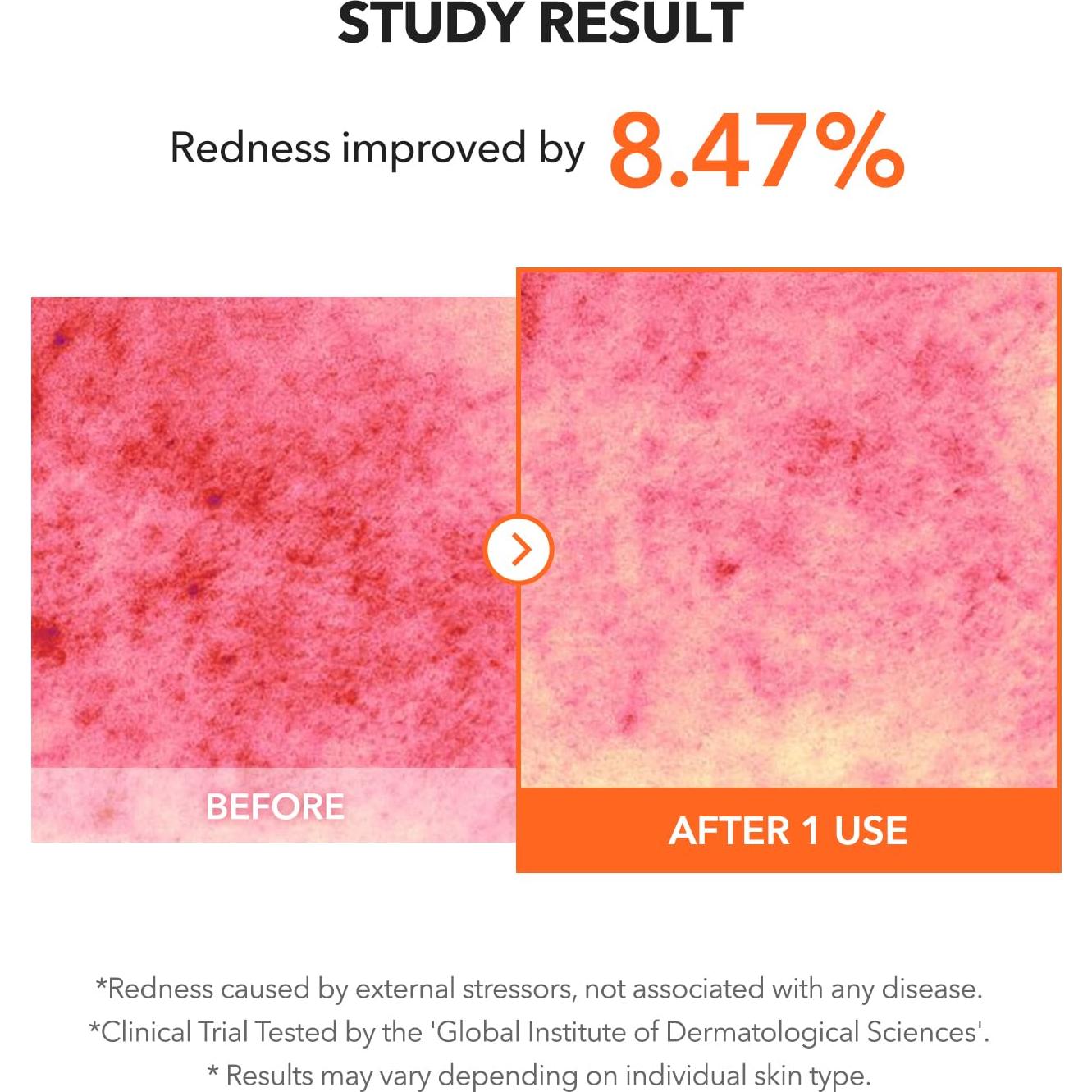 APRILSKIN Solución Limpiadora Carrotene IPMP 19.9ml - Vegana