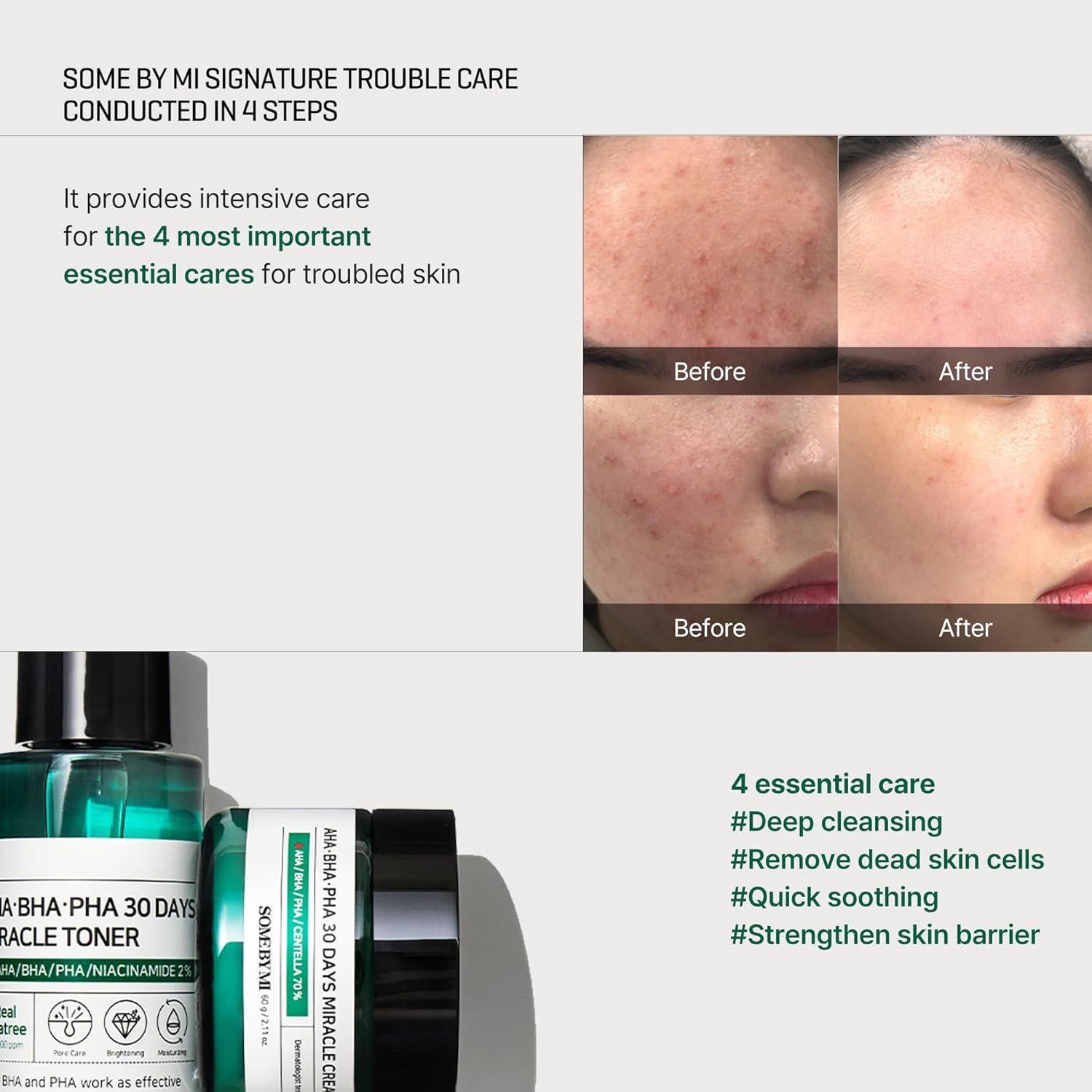 Kit de Cuidado Facial SOME BY MI 30 Días - Tónico 30ml, Suero 10ml, Crema 20ml, Jabón 30g