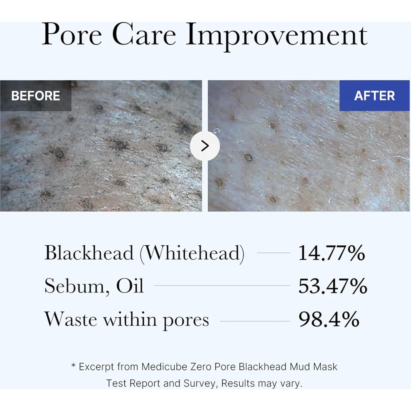 Mascarilla Facial de Barro Medicube Zero Pore 100g - Reducción de Poros y Puntos Negros