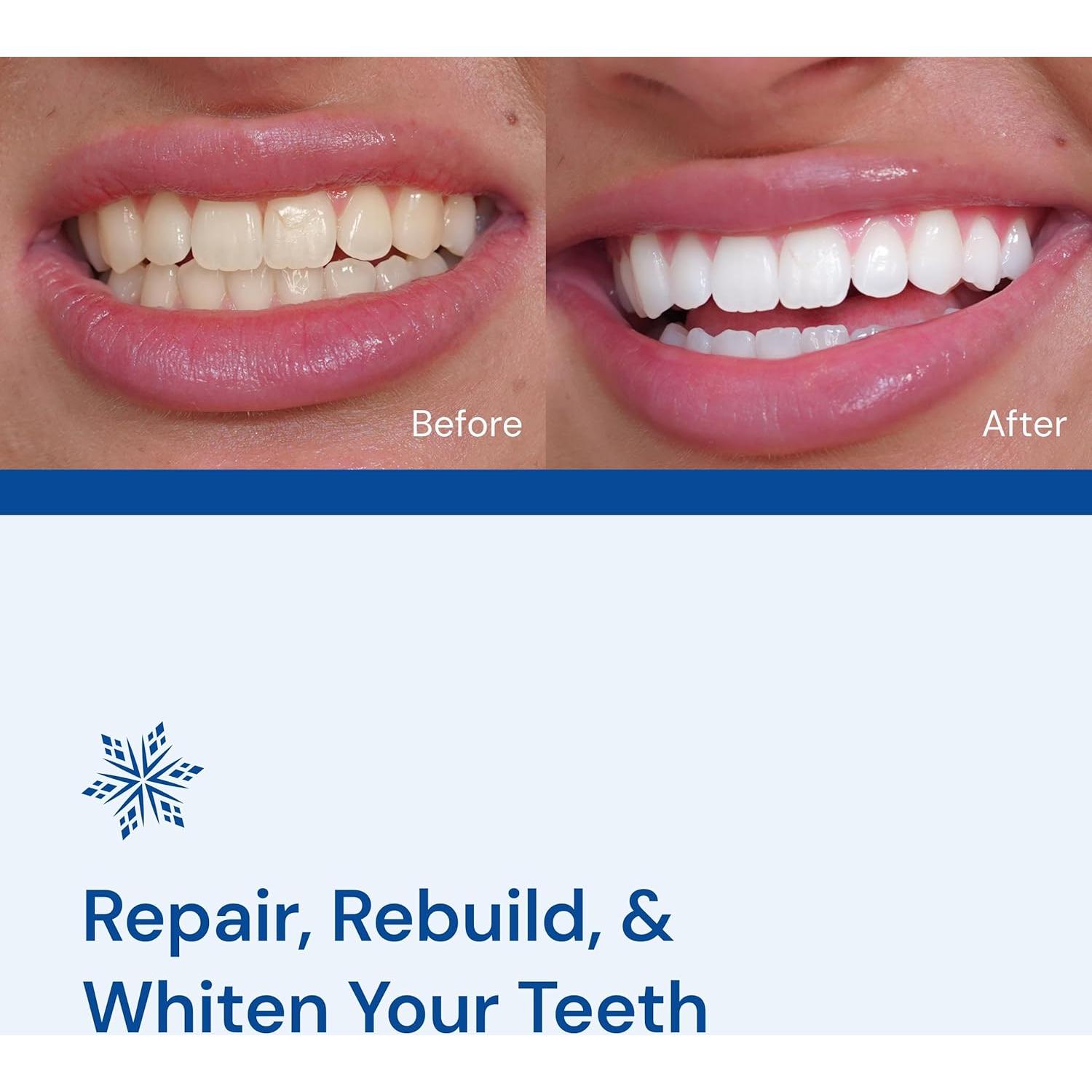 Kit de Blanqueamiento Dental Snow - Suero LED y Boquilla