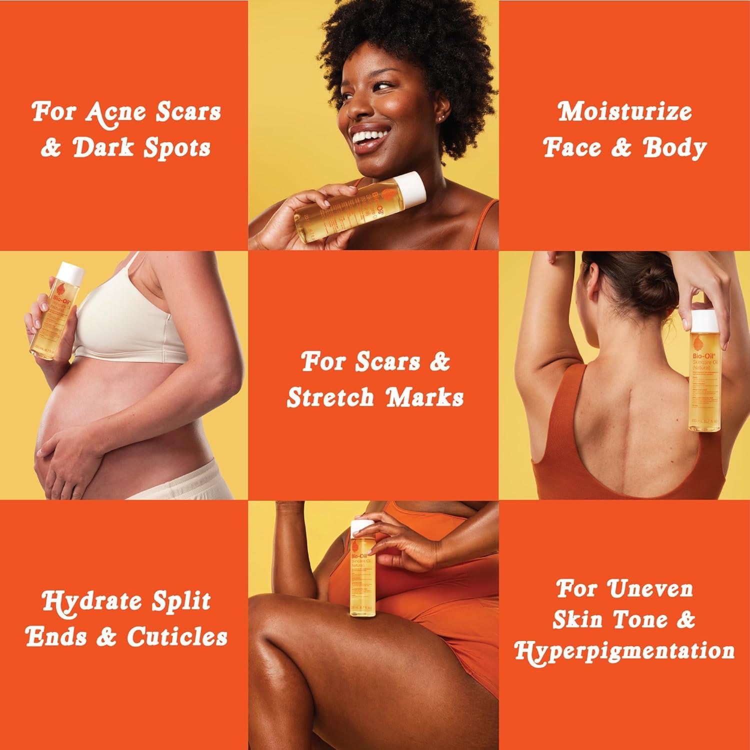 Bio-Oil Aceite Natural 118 ml para Cicatrices y Estrías