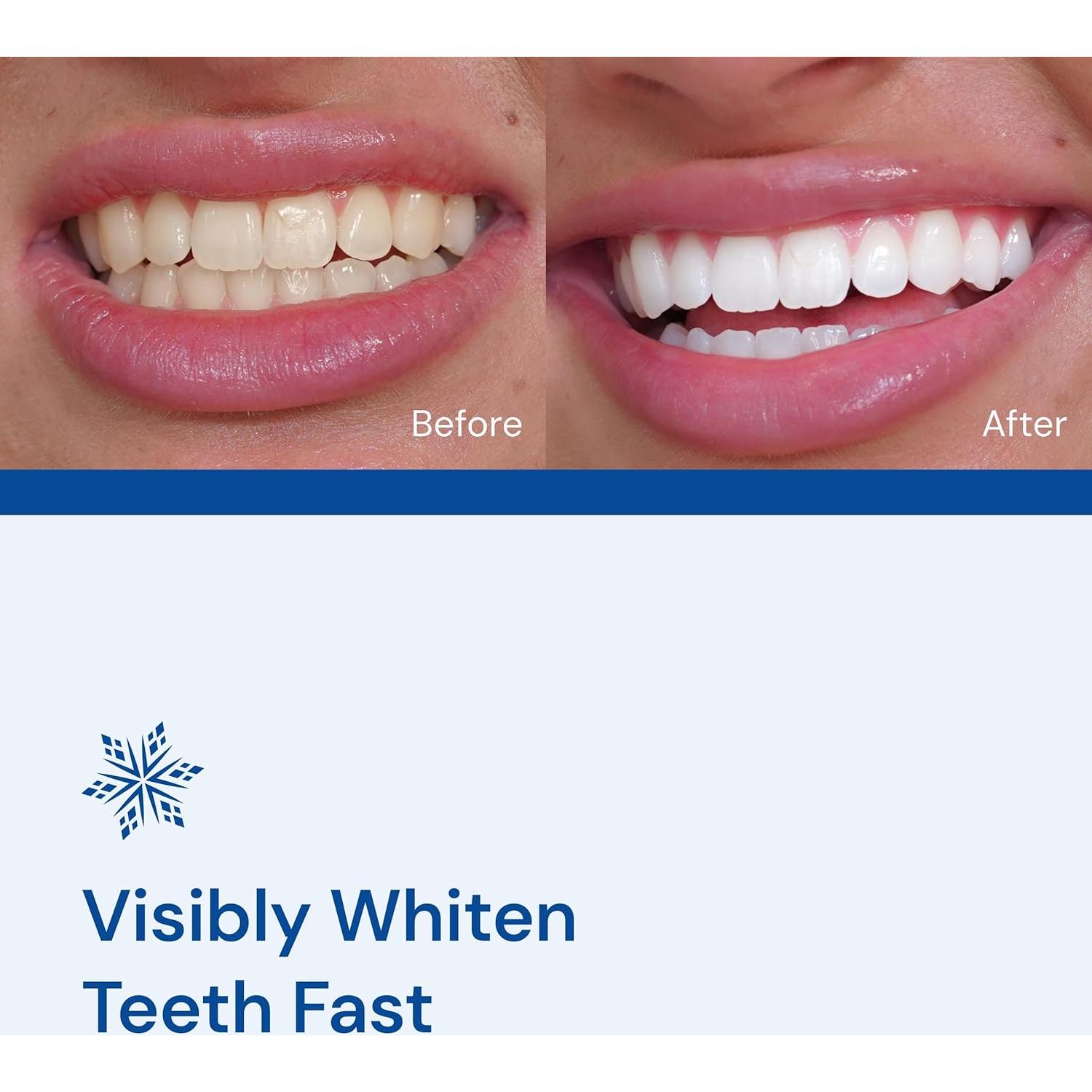 Tiras Blanqueadoras SNOW Diamond Dissolving - 14 Unidades