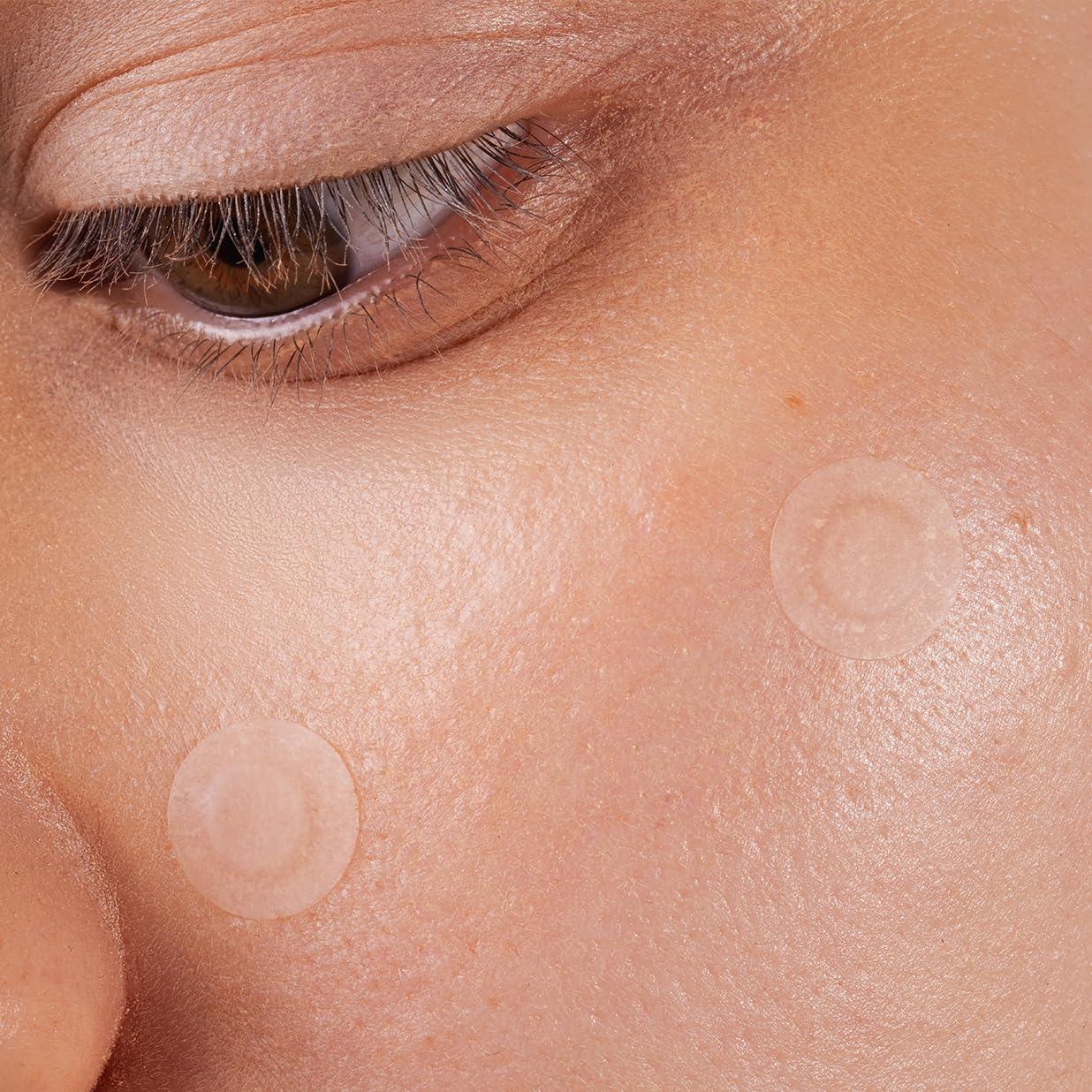 Parche Hidrocoloide para Acné Stryke Club - 60 Unidades