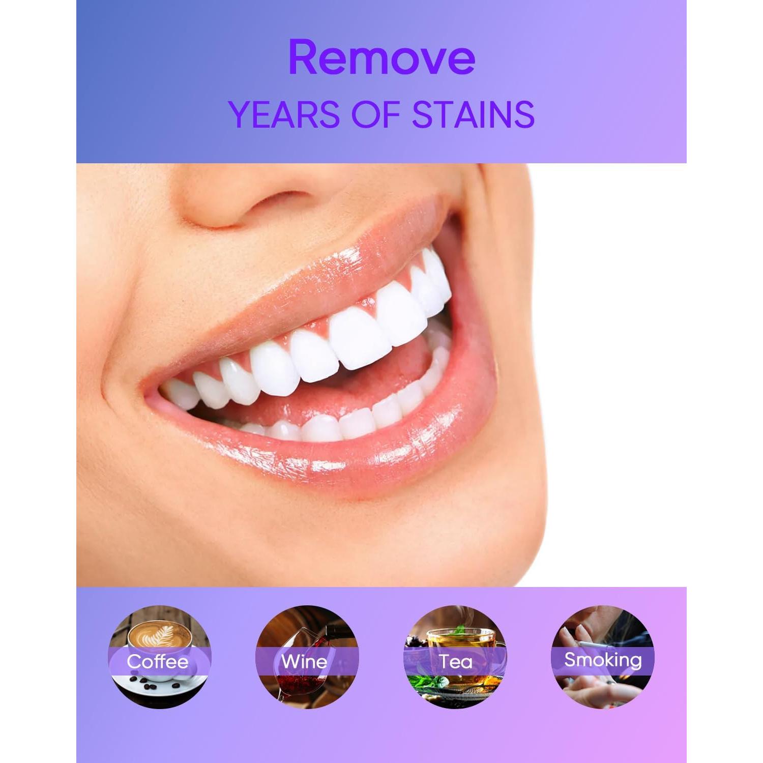 Kit Blanqueador Dental MySmile 4Pcs 35% Carbamida Sin Dolor