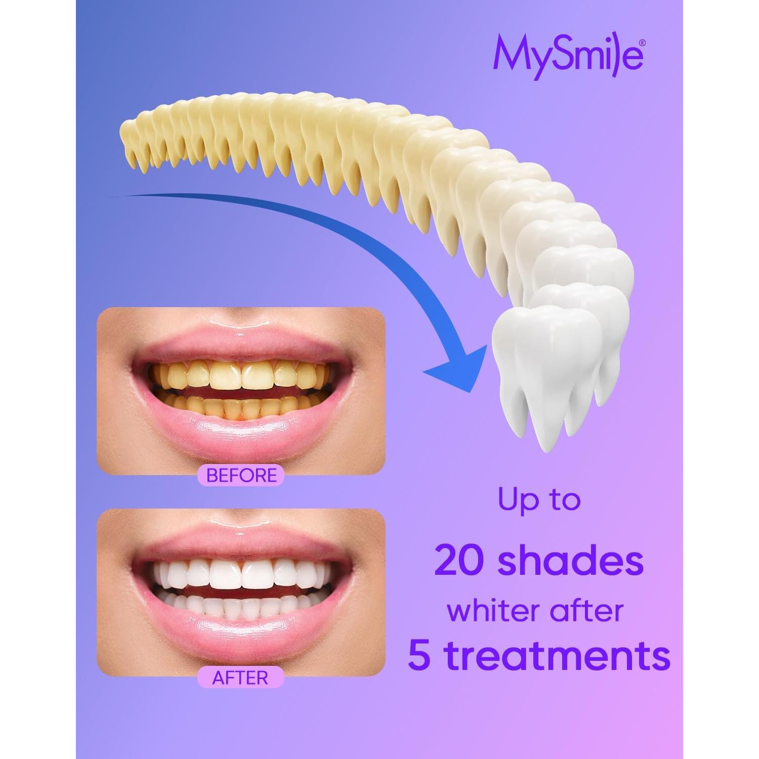 Kit Blanqueador Dental MySmile 4Pcs 35% Carbamida Sin Dolor