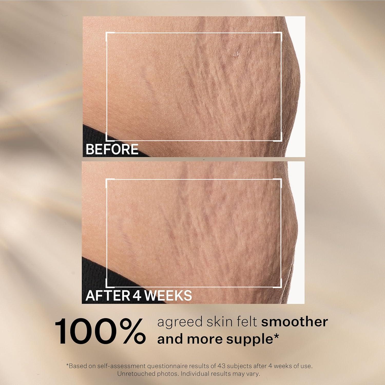 Crema Hidratante Intensiva StriVectin 60g - Arrugas y Estrías