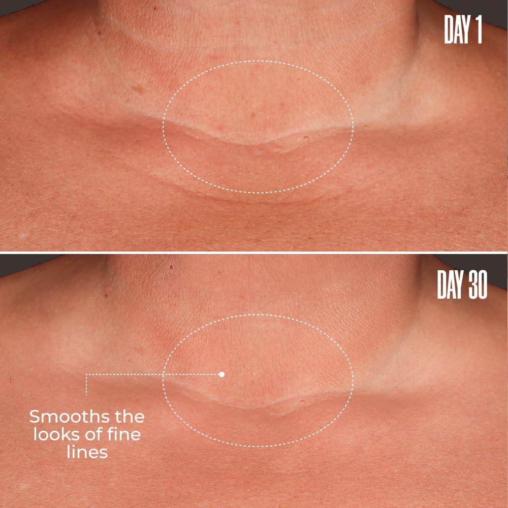 Serum Corporal Maelys B-Glossy 95g - Anti-Envejecimiento con Ácido Hialurónico