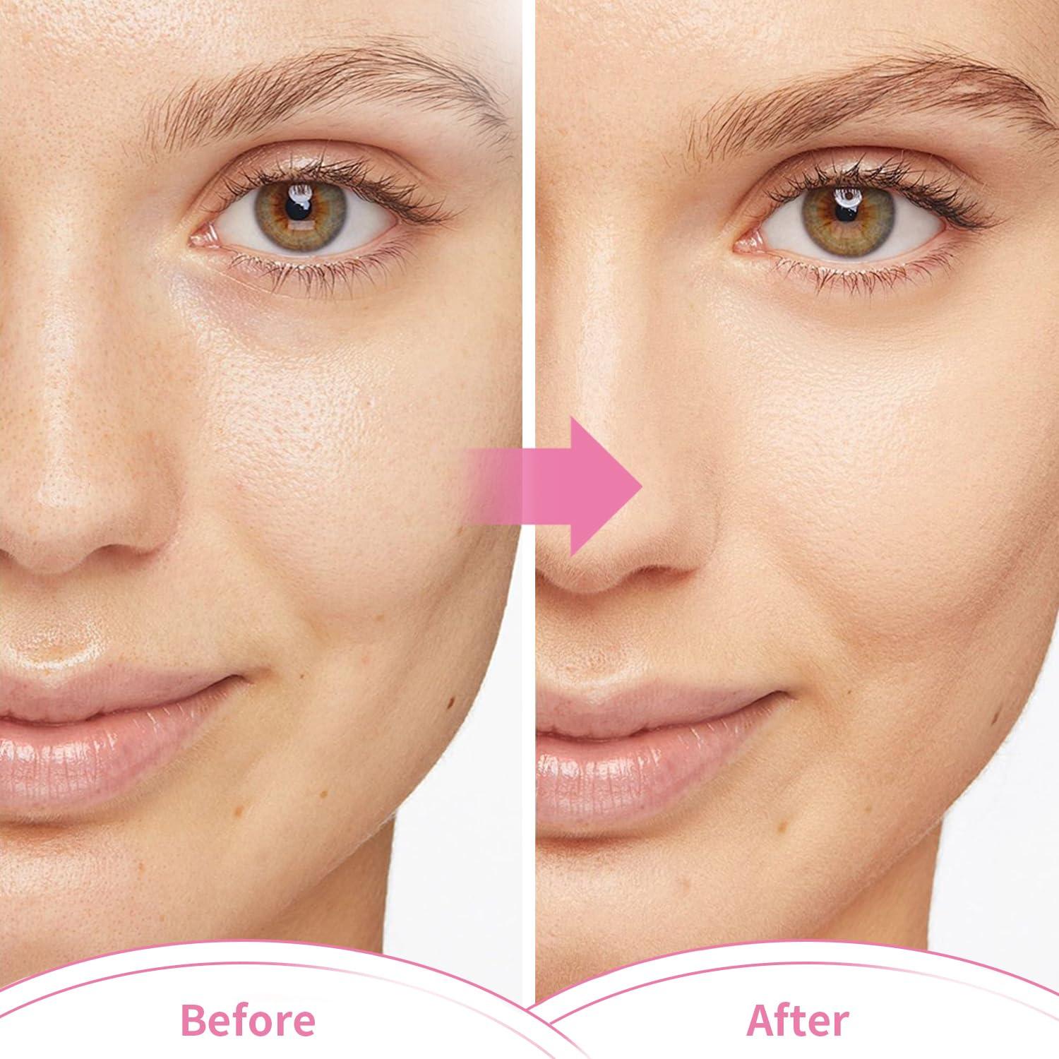 Máscara Fría para Ojos Conbella 18x20 cm Gel Reutilizable