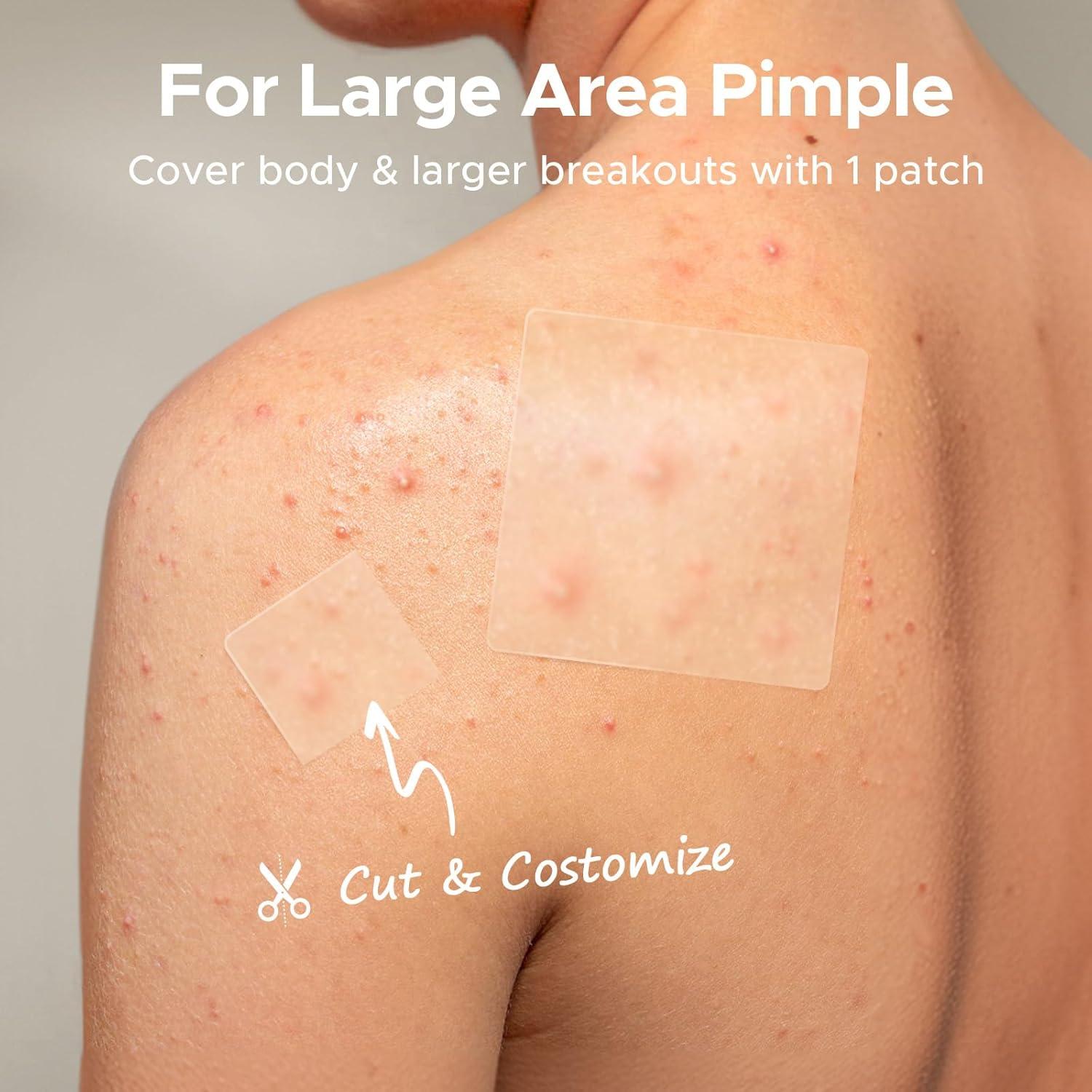 Parches para Granos XL TKTK 60 mm Hidrocoloide 62 Piezas