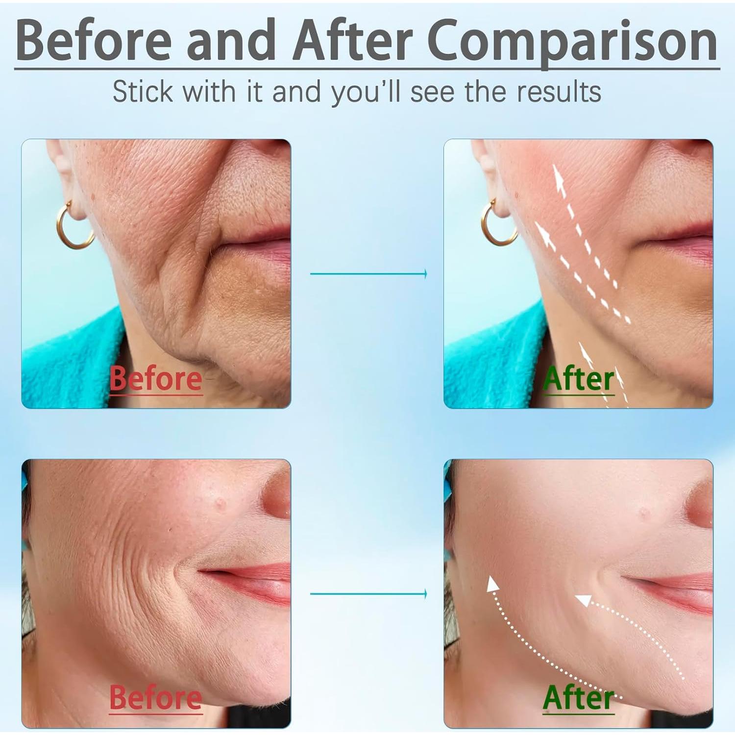 Masajeador Facial y de Cuello JURP ES-1081 con 3 LED