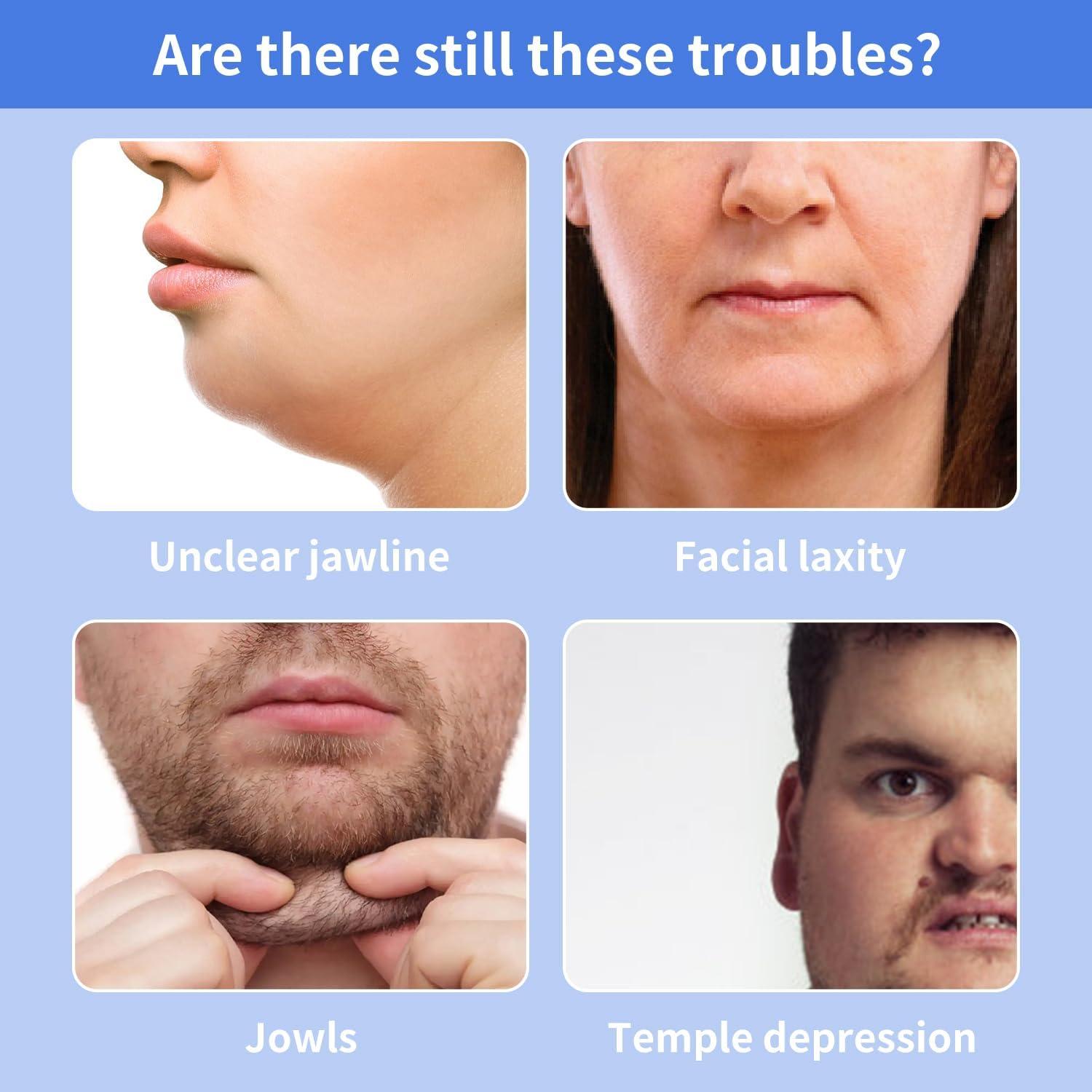 Ejercitador de Mandíbula Keroius GSW88601 - Silicona 2 Pcs