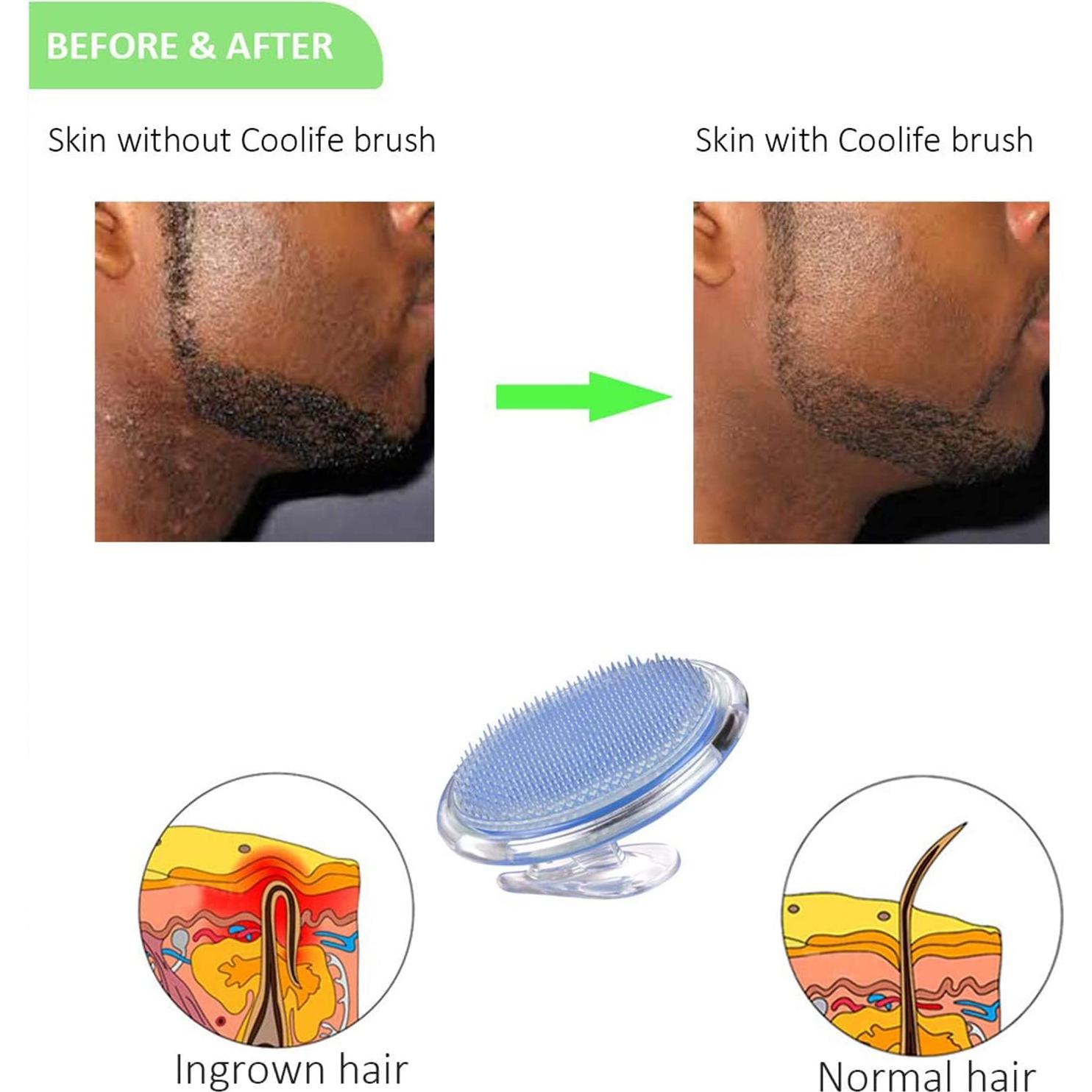 Coolife Removedor de Vello Encarnado y Exfoliante Corporal