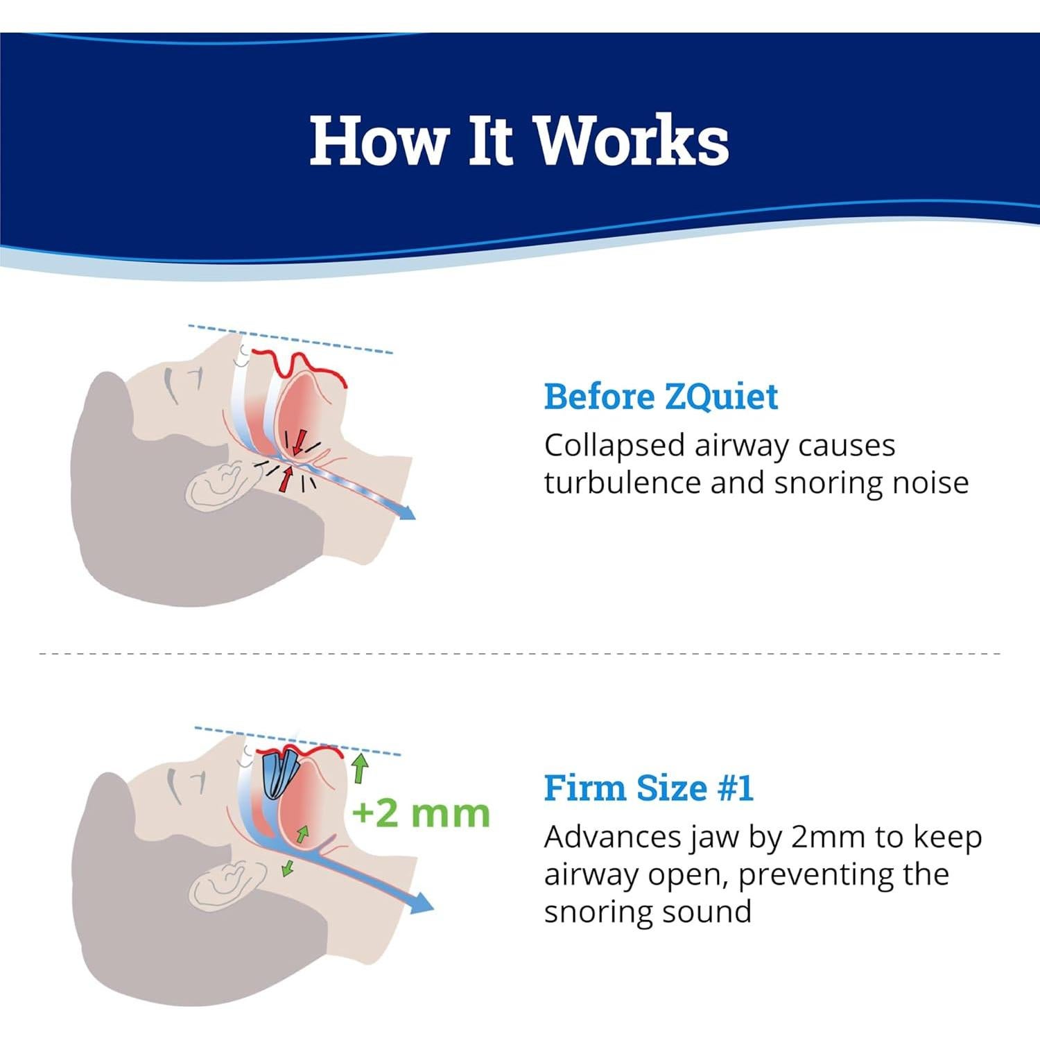 Protector Bucal Antisnoring ZQuiet Firme 1 - Duradero y Efectivo
